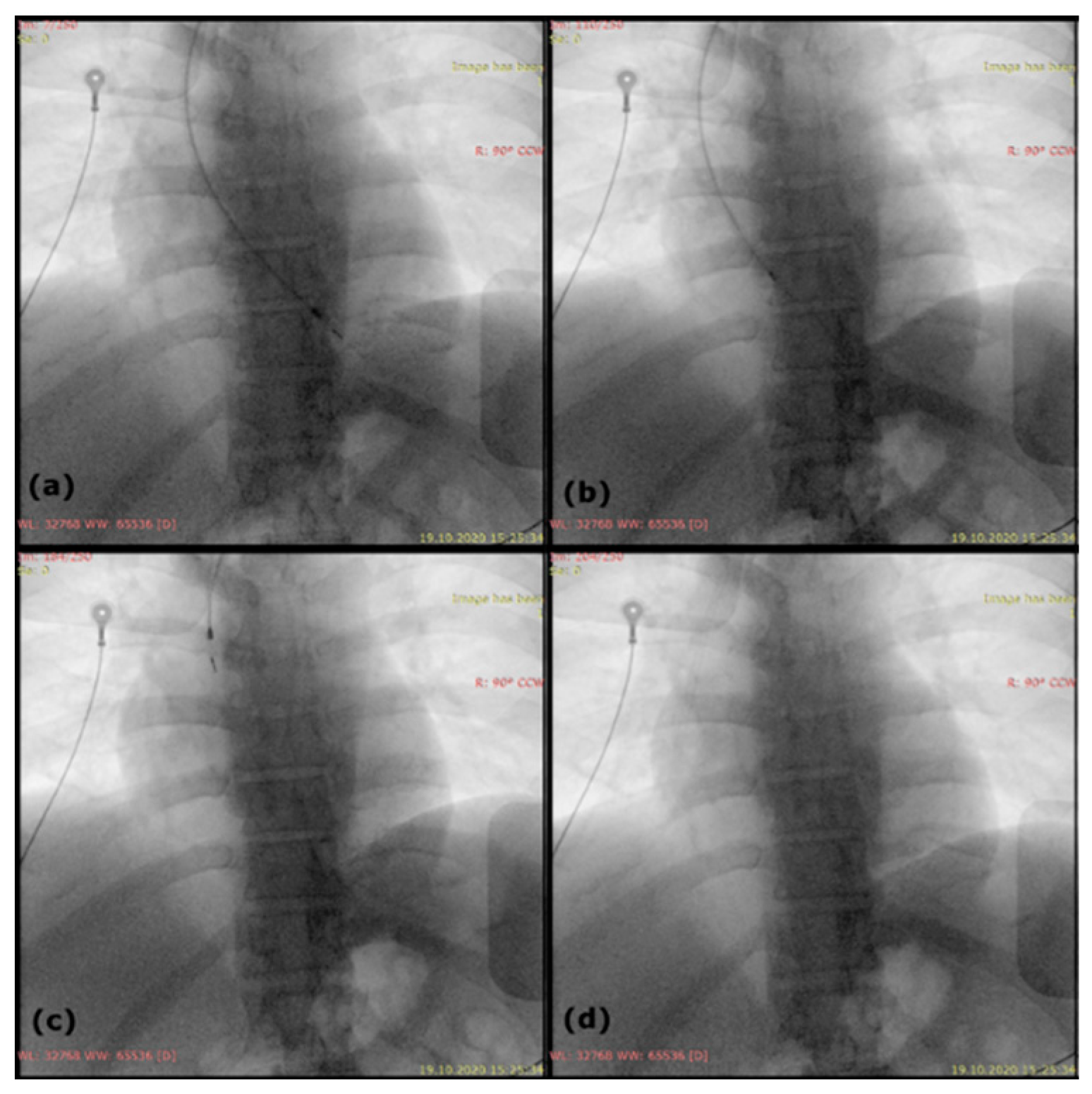 Diagnostics 11 00096 g005
