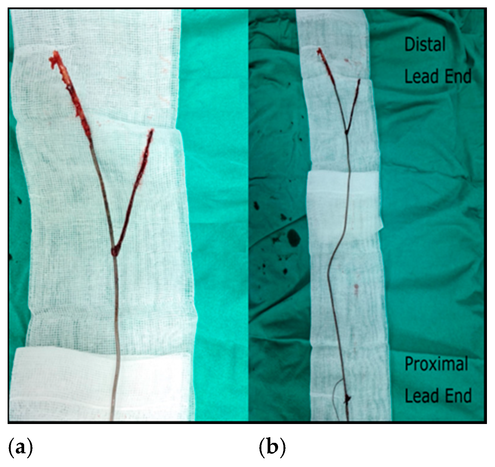 Diagnostics 11 00096 g006