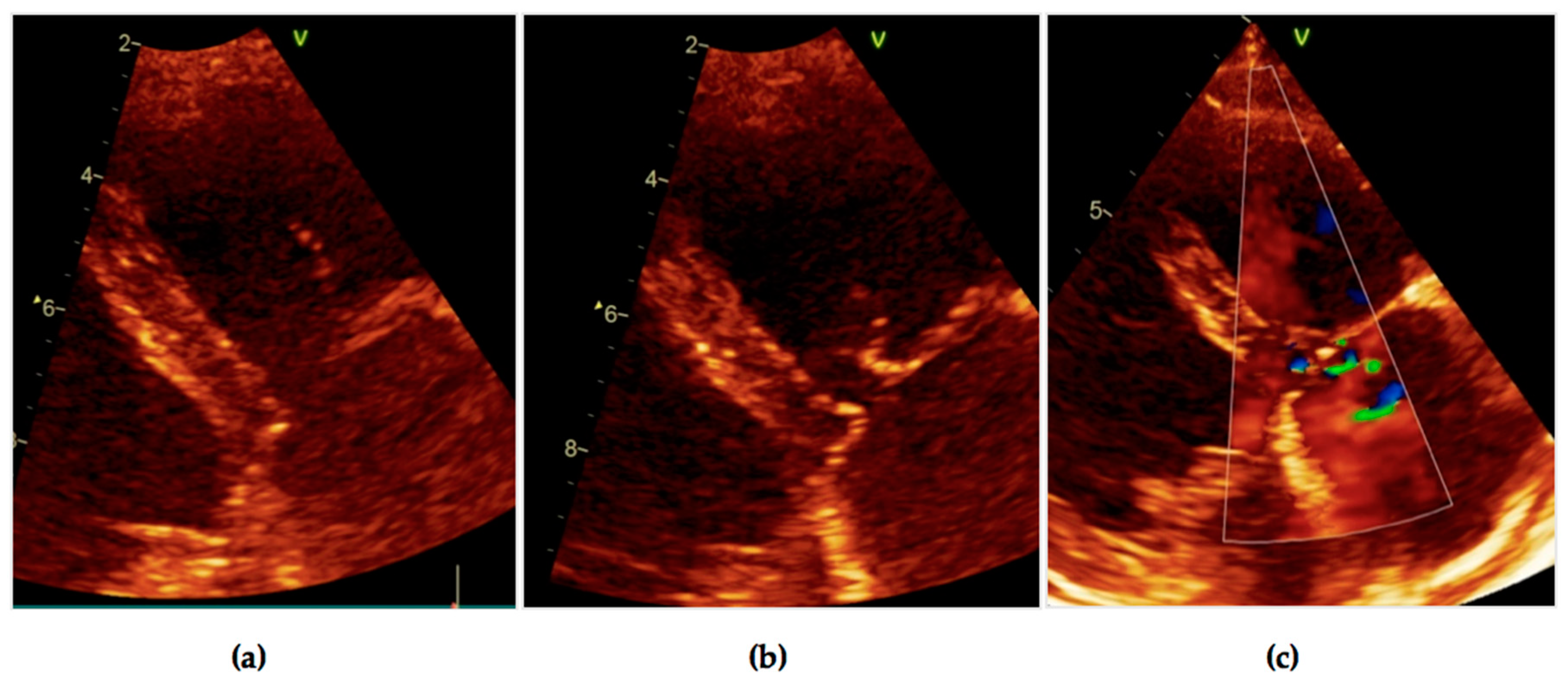 Diagnostics 11 00096 g008