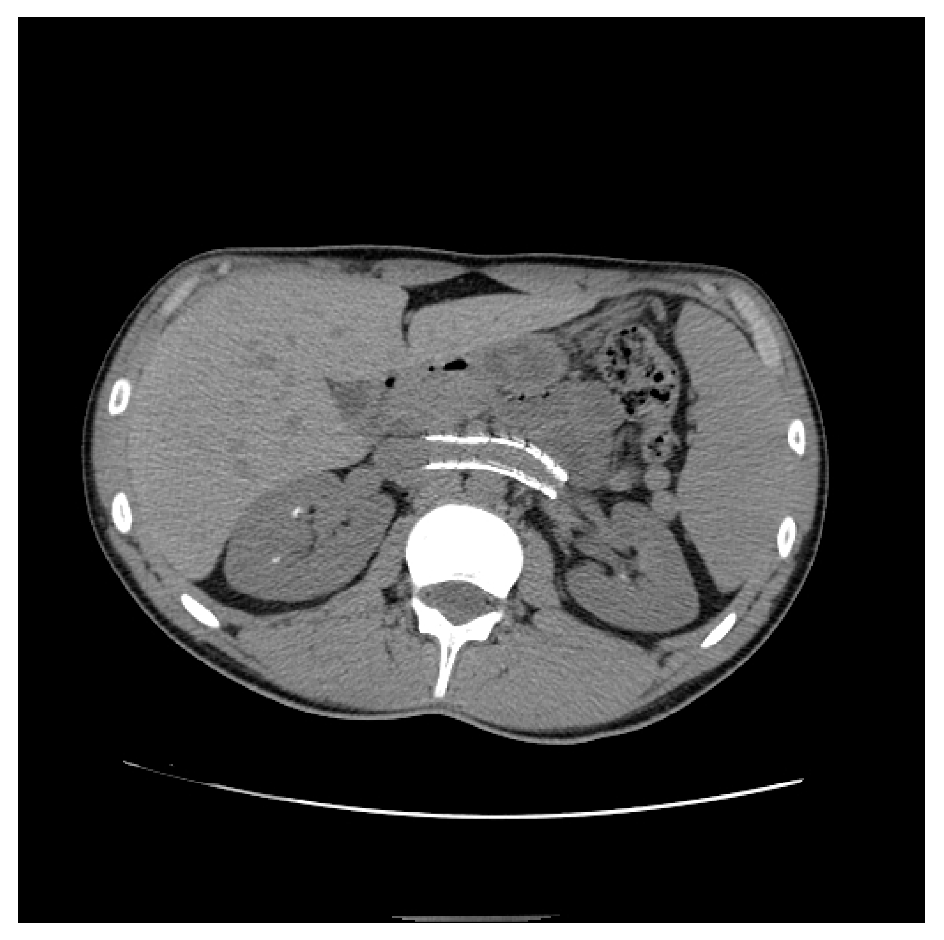 Diagnostics 11 00101 g014 Diagnostics 11 00101 g014