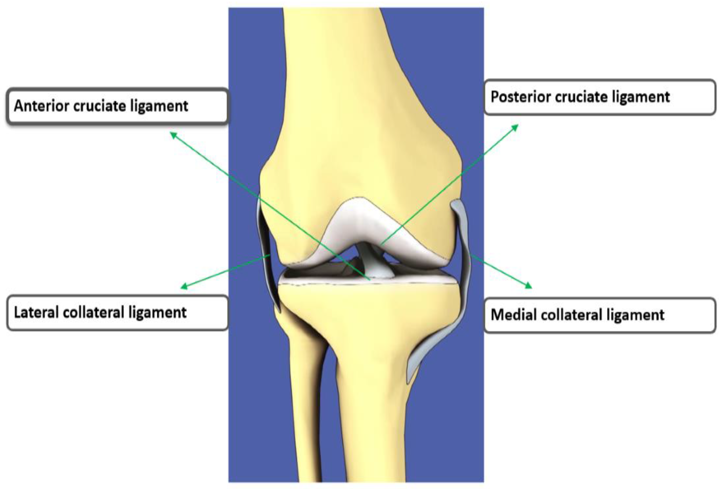 Diagnostics Free Full Text Efficient Detection Of Knee Anterior Cruciate Ligament From Magnetic Resonance Imaging Using Deep Learning Approach