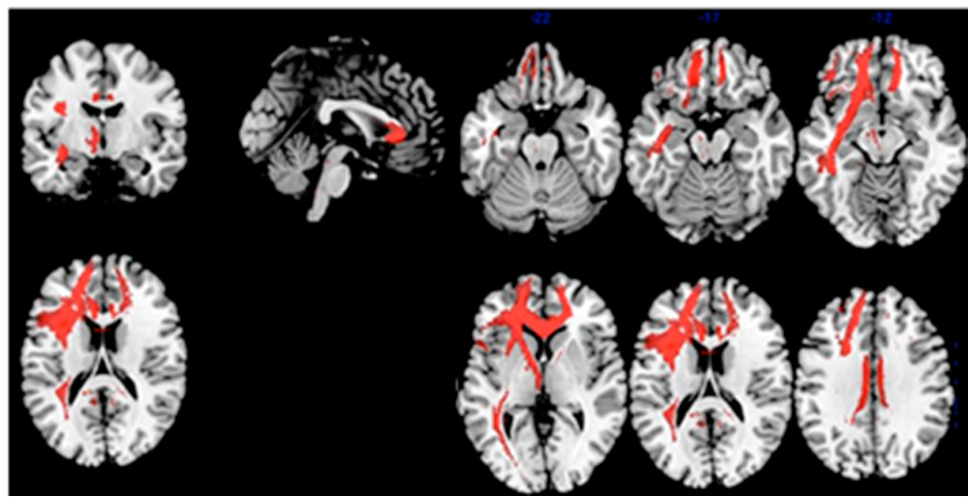Diagnostics 11 00108 g004