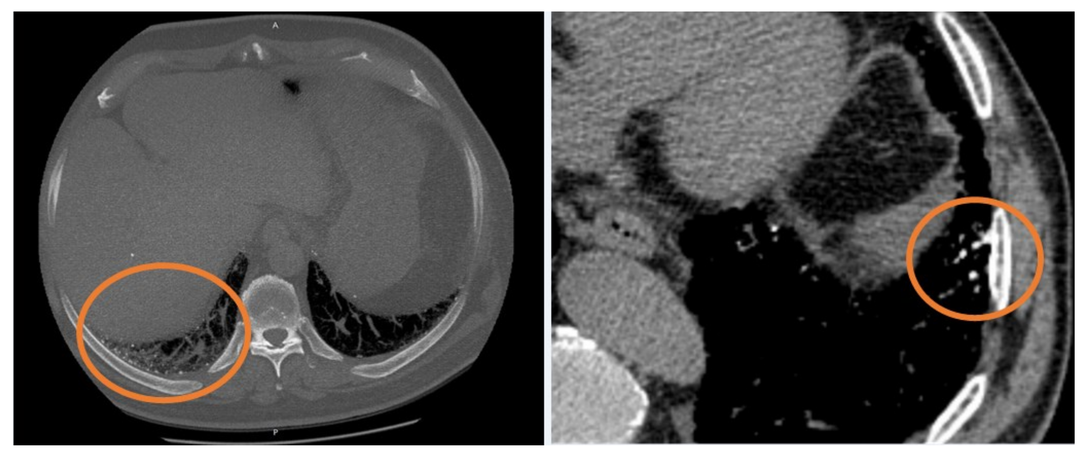 Diagnostics 11 00113 g001