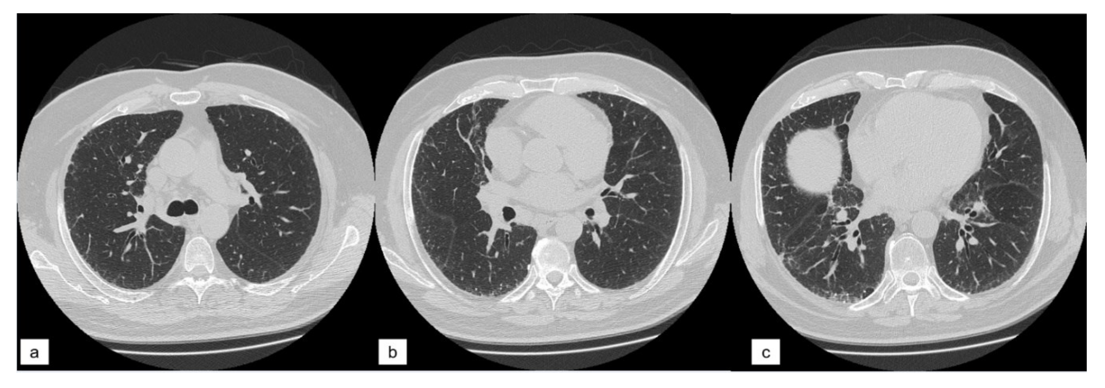 Diagnostics 11 00113 g002