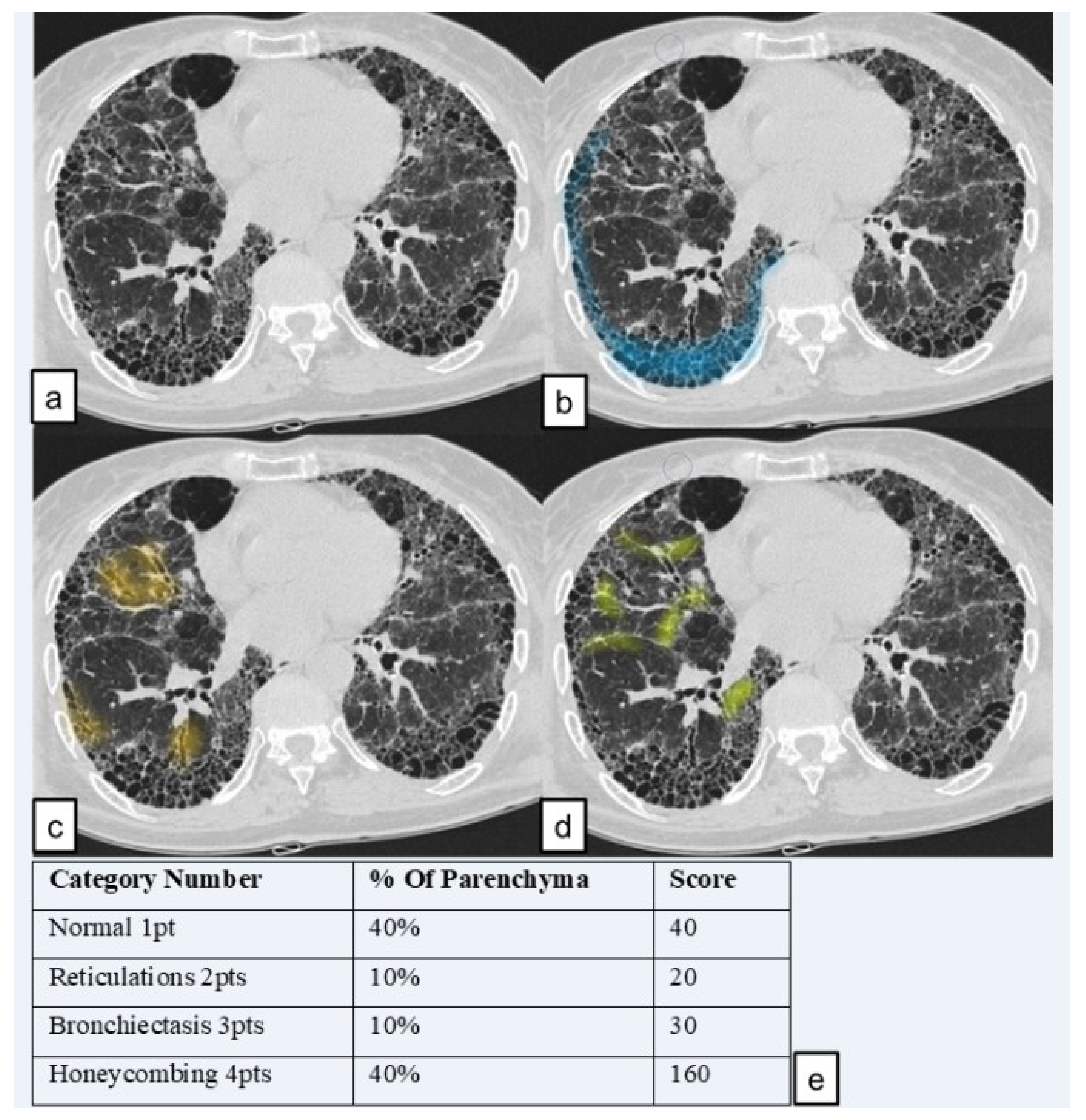 Diagnostics 11 00113 g004