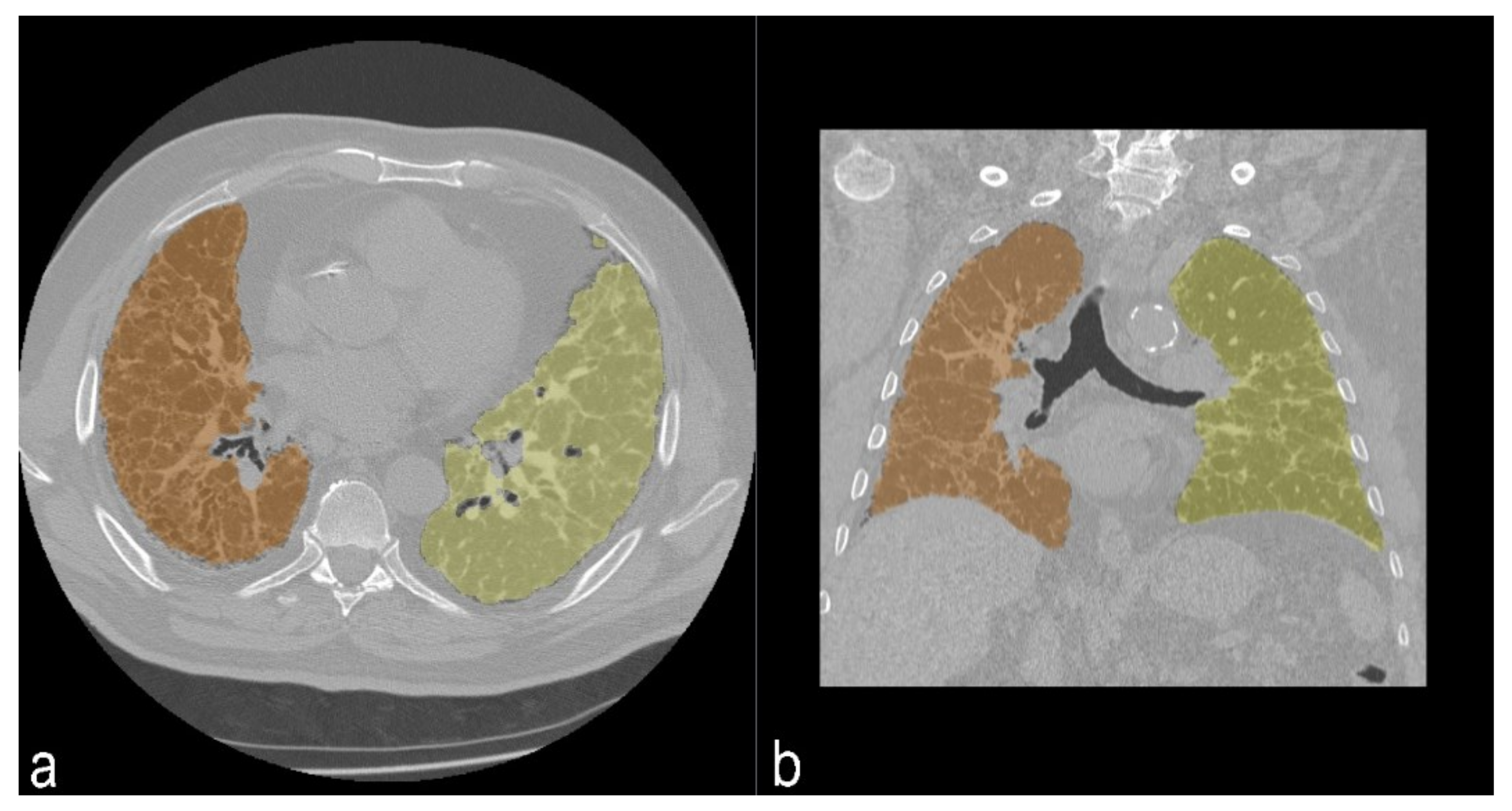 Diagnostics 11 00113 g005