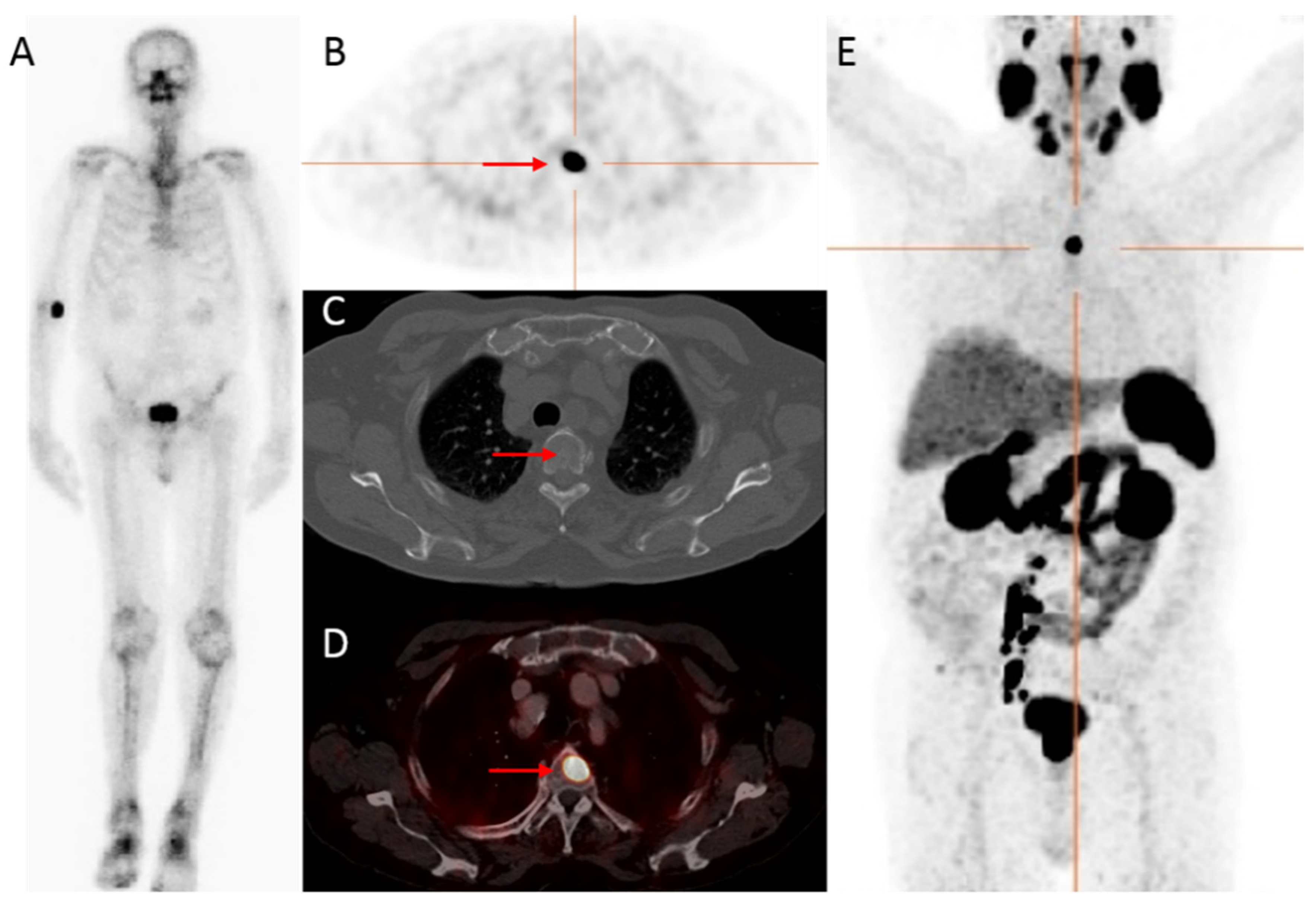 diagnostic aleglandei prostatei)