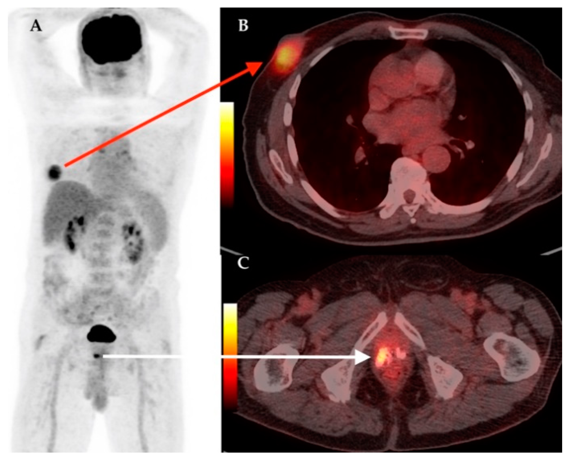 Diagnostics 11 00119 g004