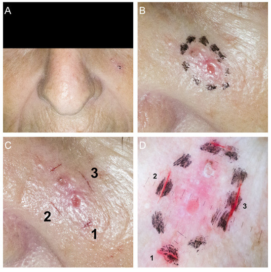 Diagnostics Free FullText Preoperative Evaluation through