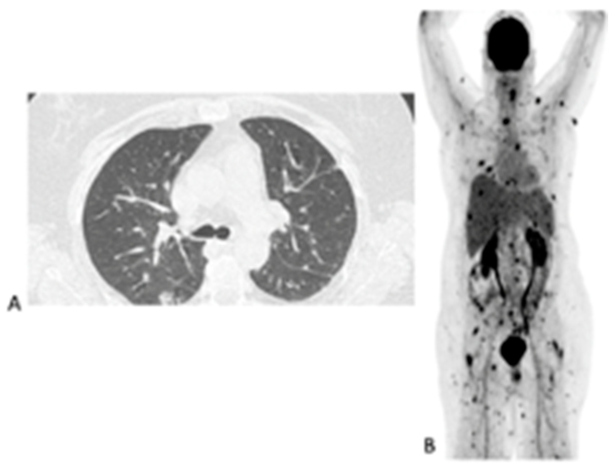 Diagnostics 11 00137 g004