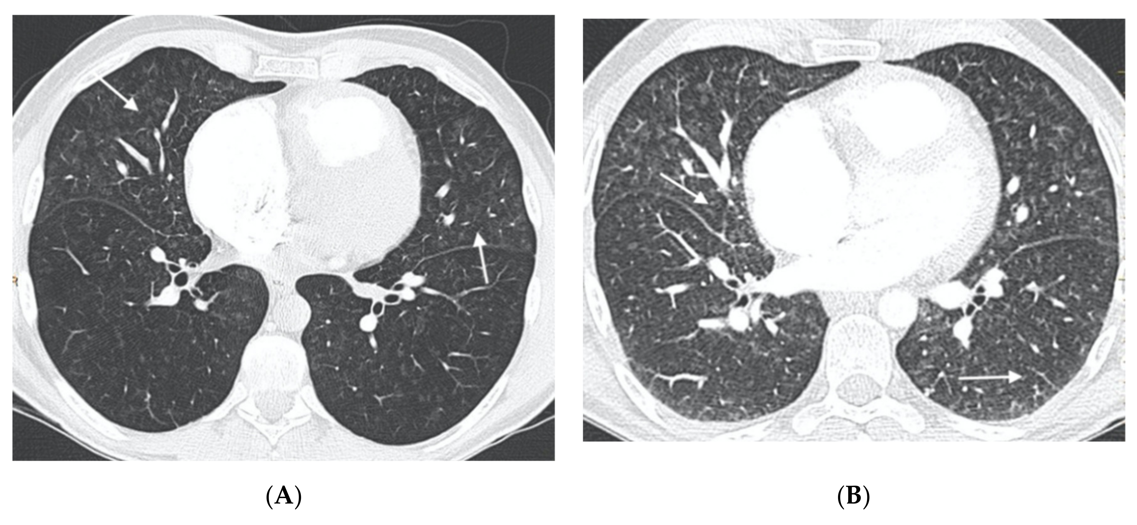 Diagnostics 11 00141 g002
