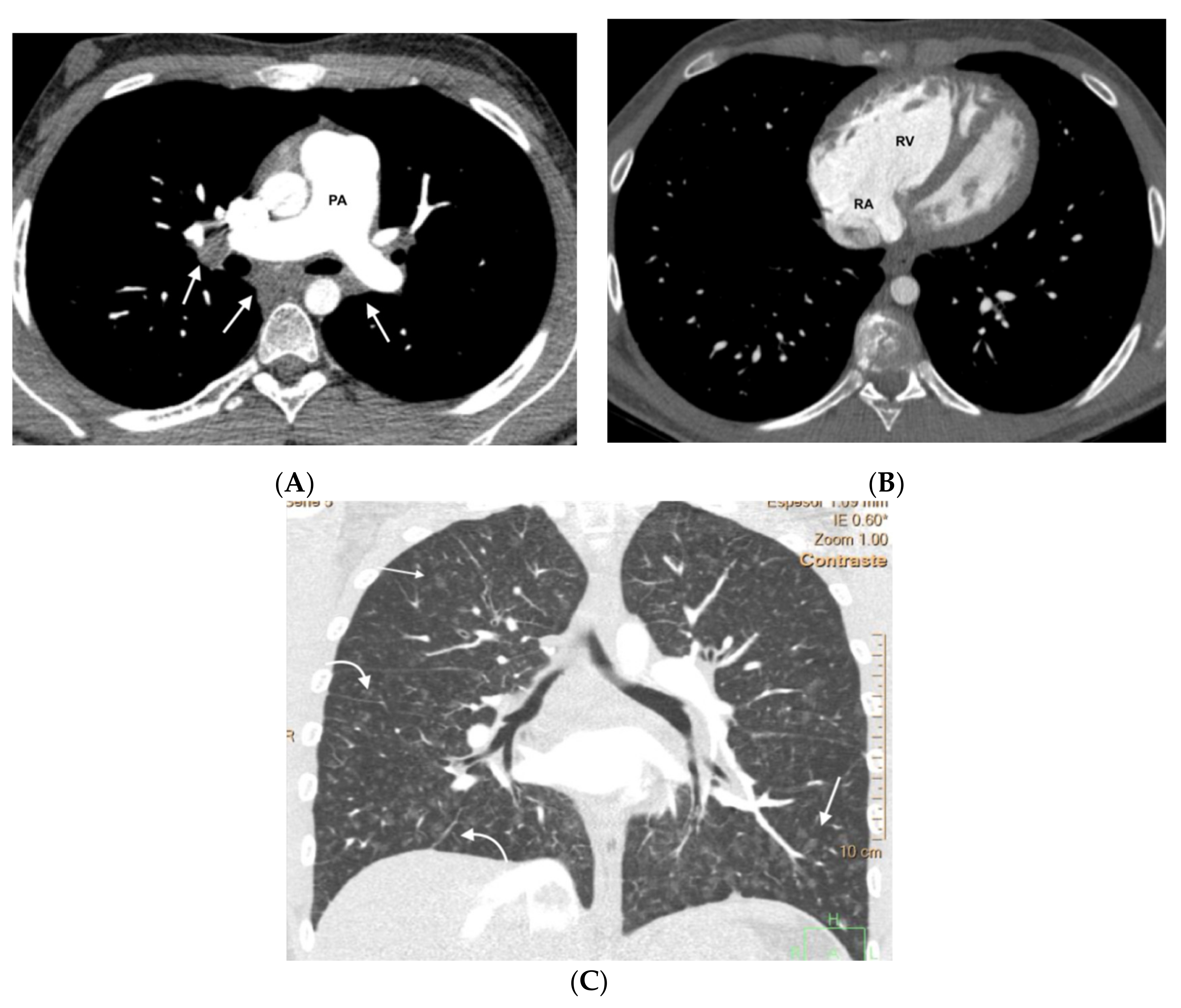 Diagnostics 11 00141 g003
