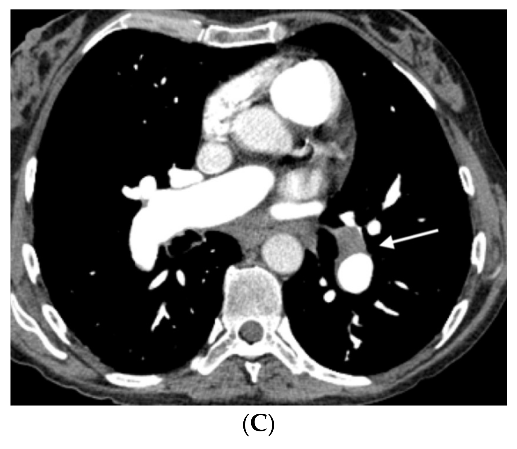 Diagnostics 11 00141 g004b