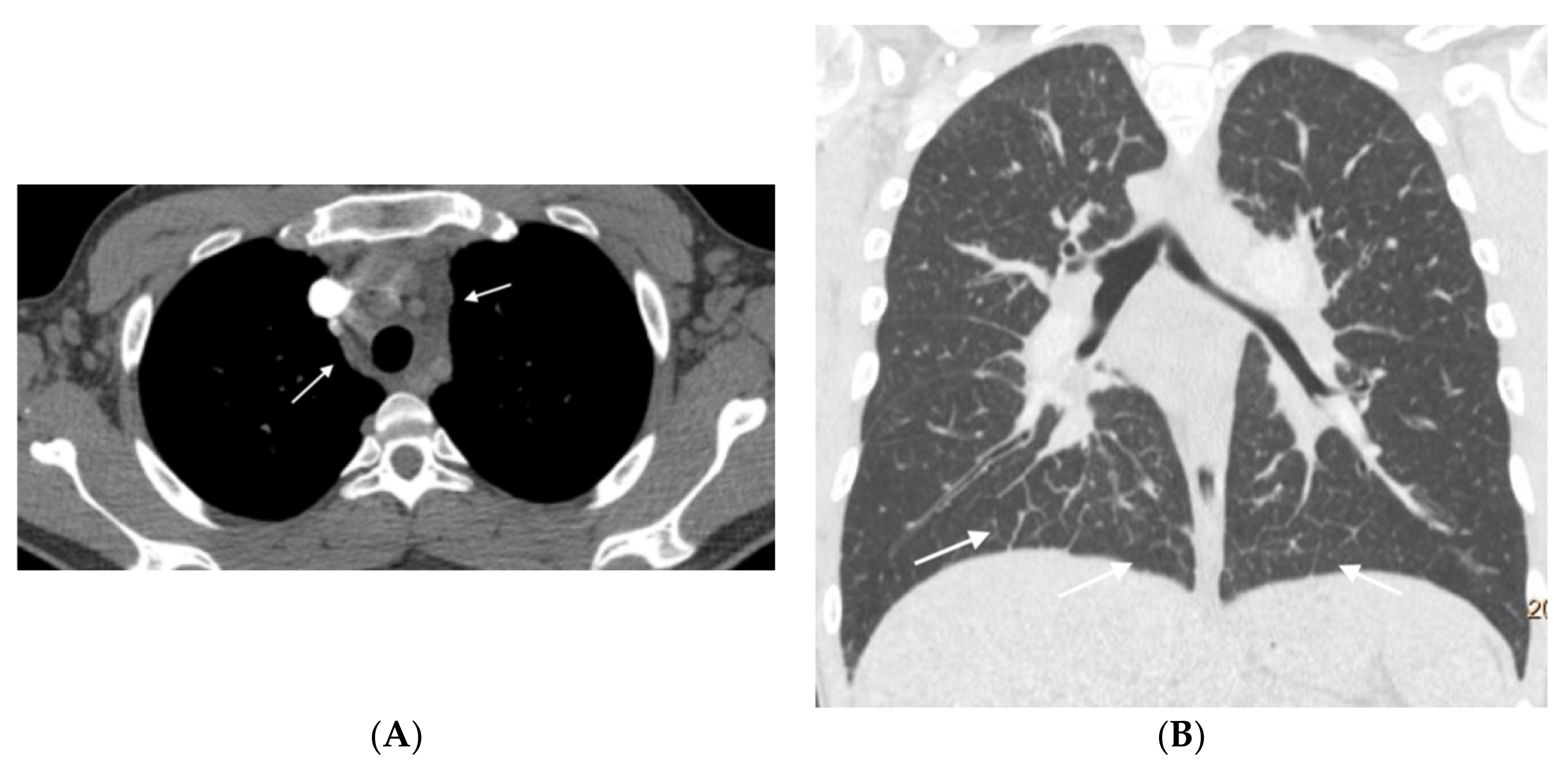 Diagnostics 11 00141 g006