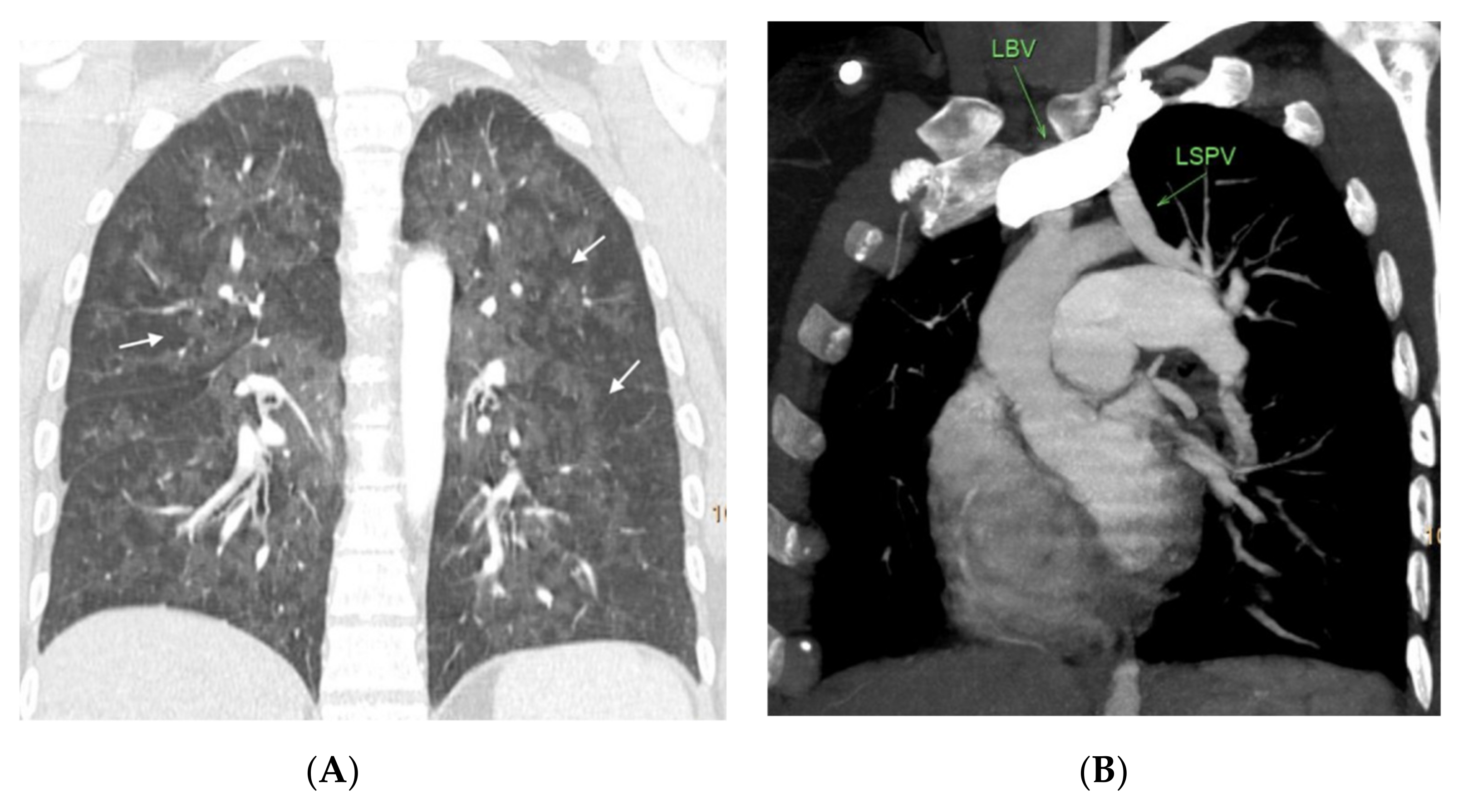 Diagnostics 11 00141 g007