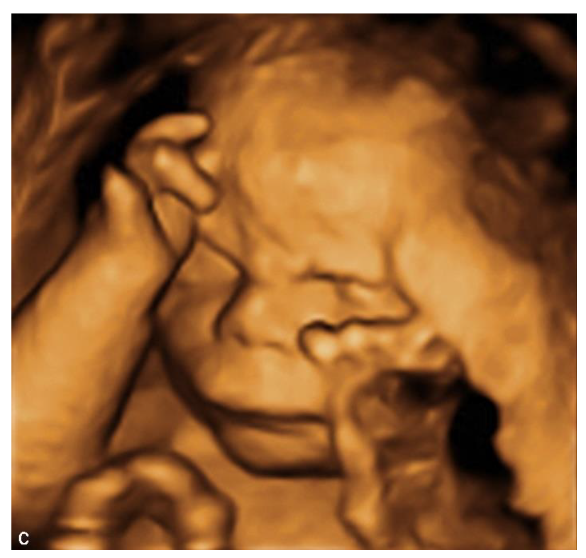 Diagnostics 11 00142 g001b Diagnostics 11 00142 g001b