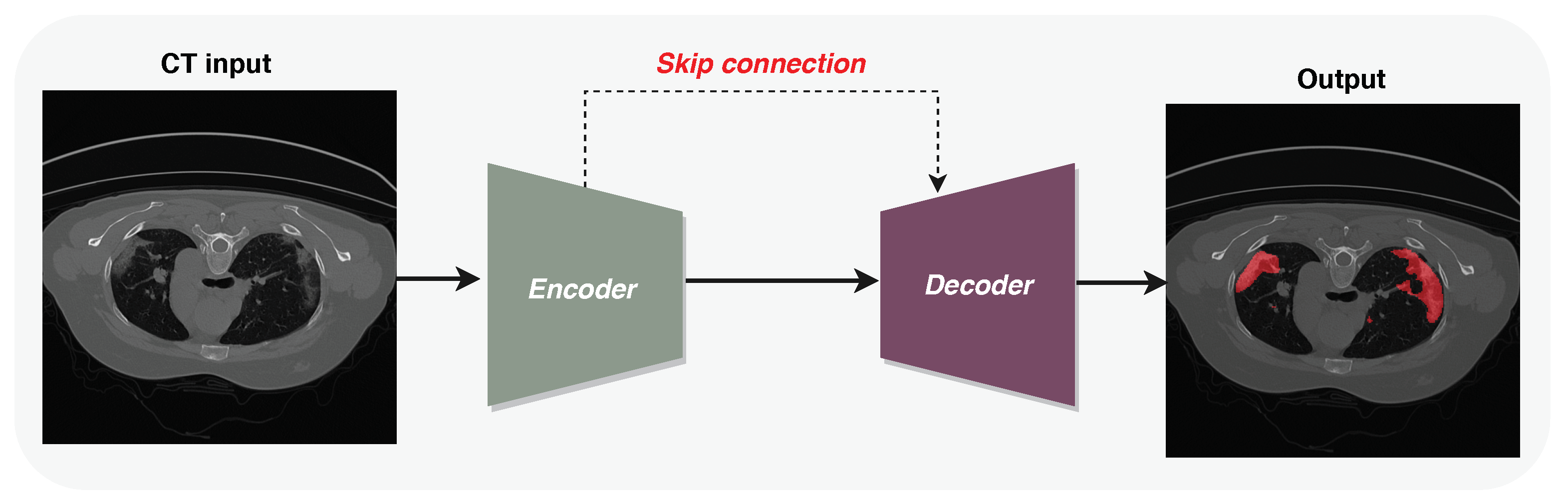 Diagnostics 11 00158 g002