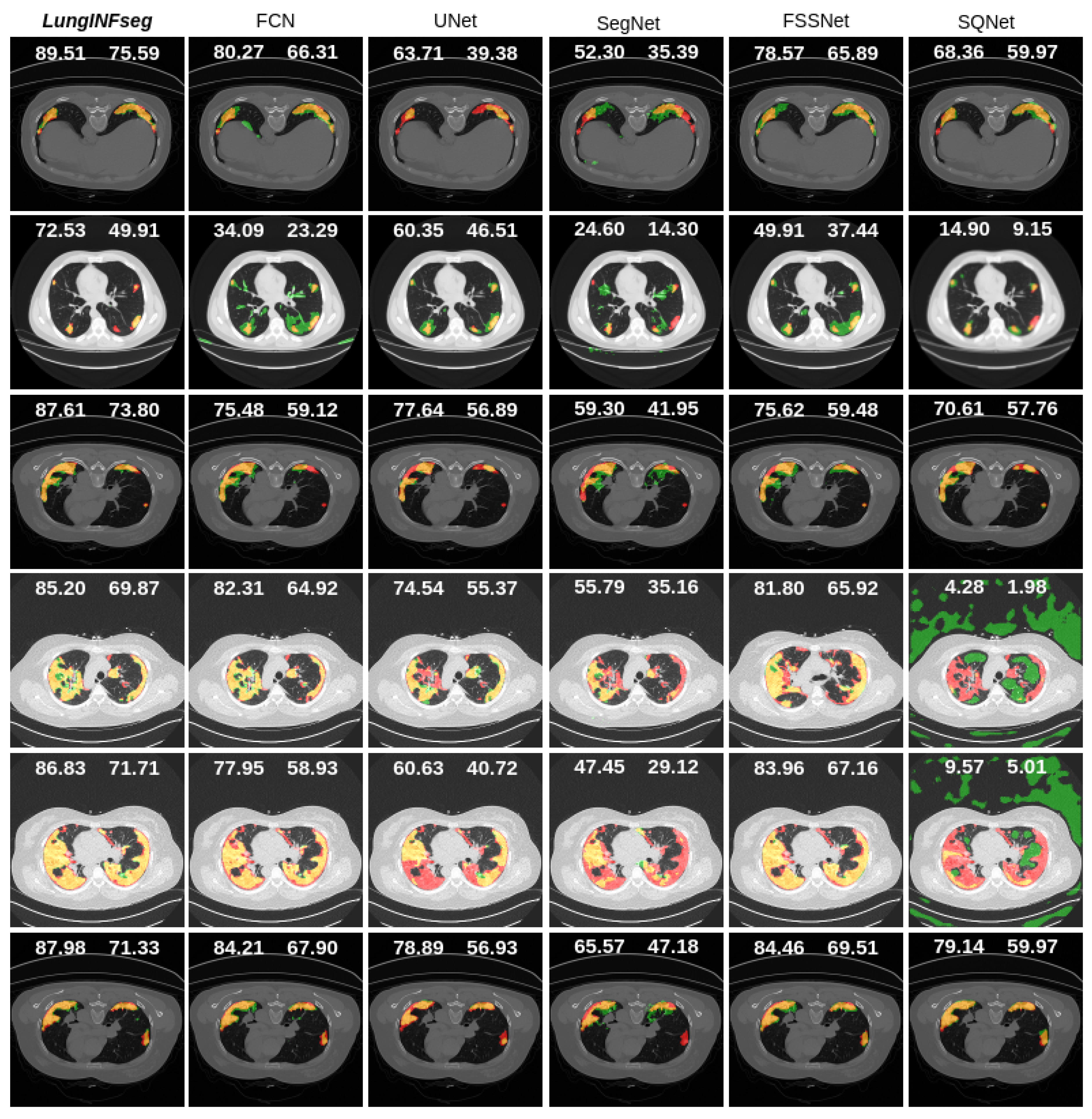Diagnostics 11 00158 g014