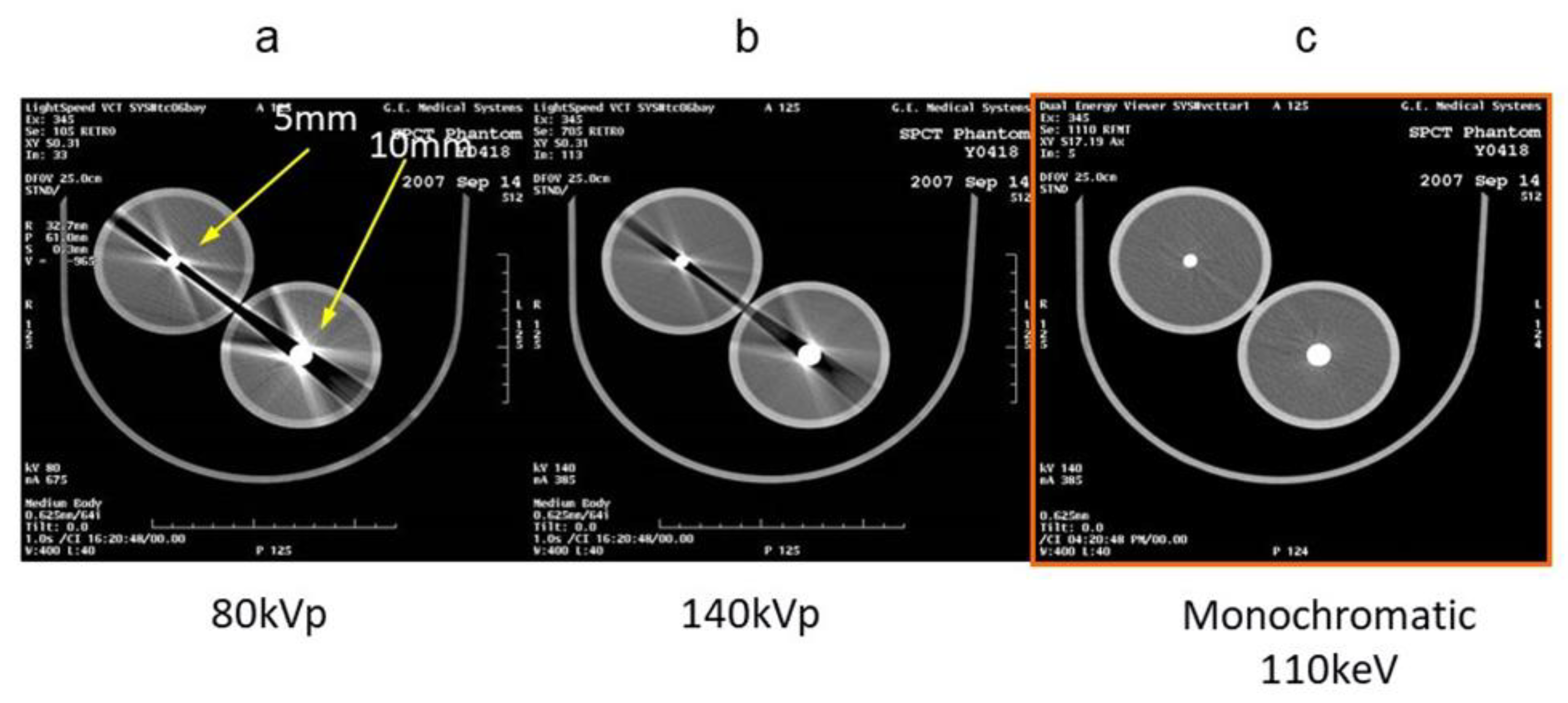 Diagnostics 11 00161 g003 Diagnostics 11 00161 g003