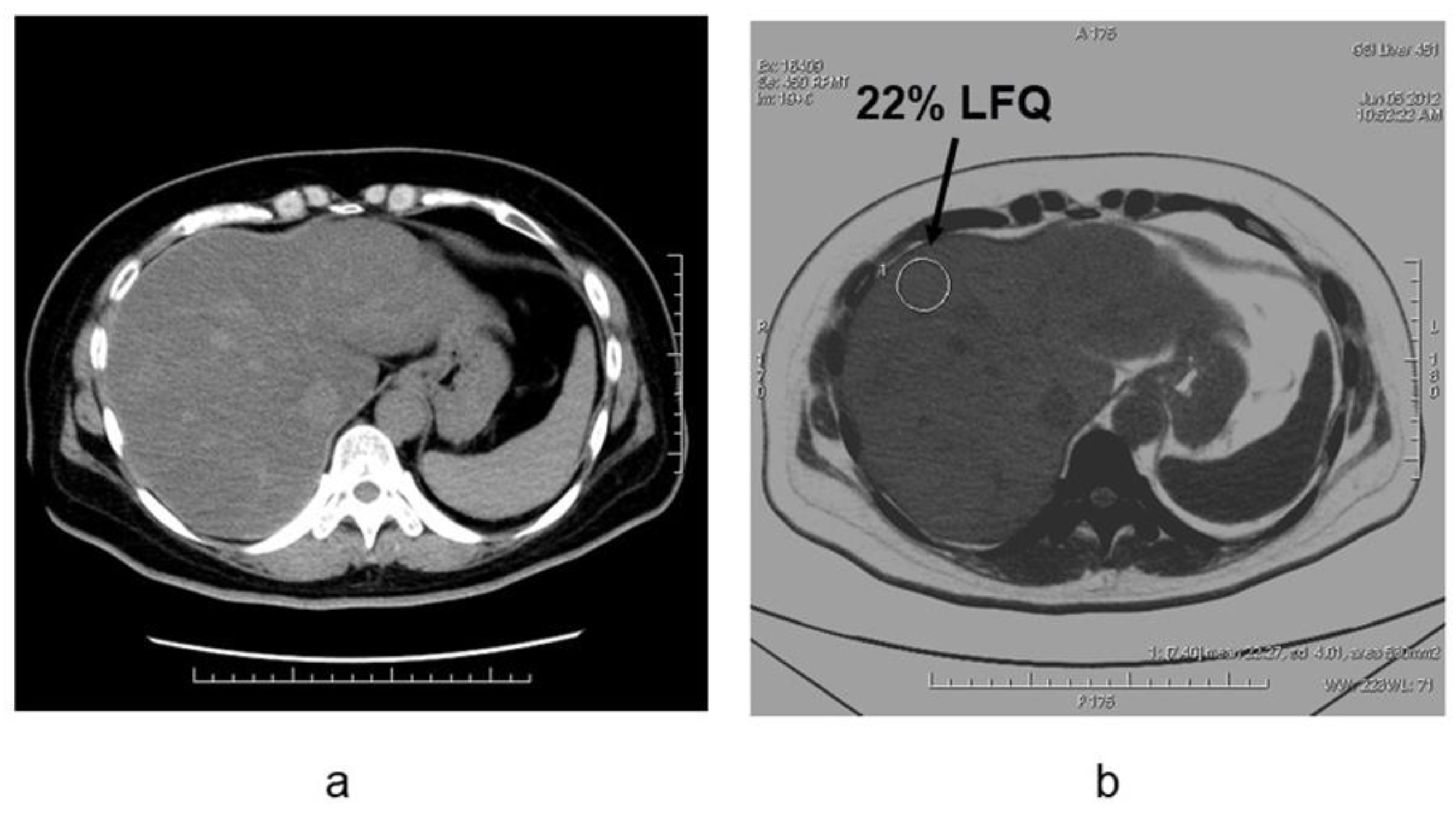 Diagnostics 11 00161 g006 Diagnostics 11 00161 g006
