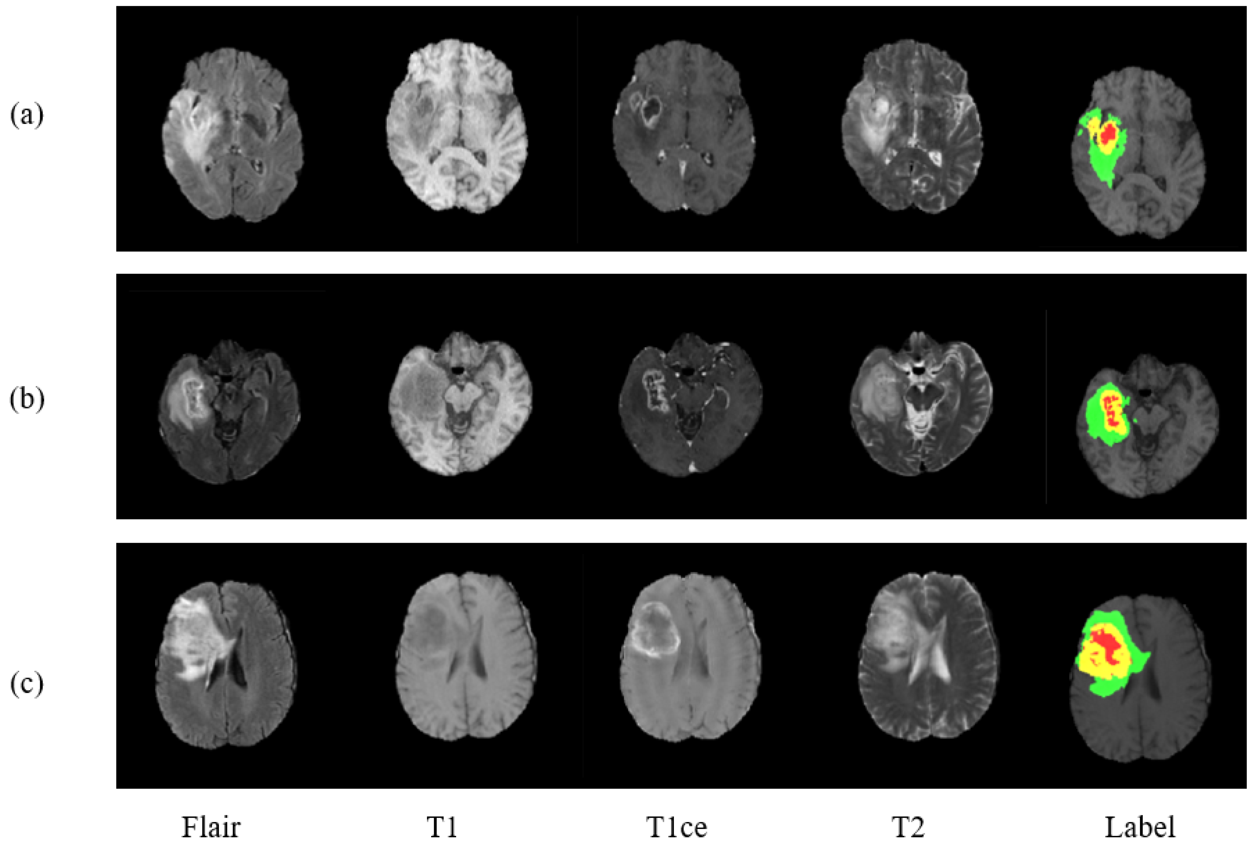 Diagnostics 11 00169 g001