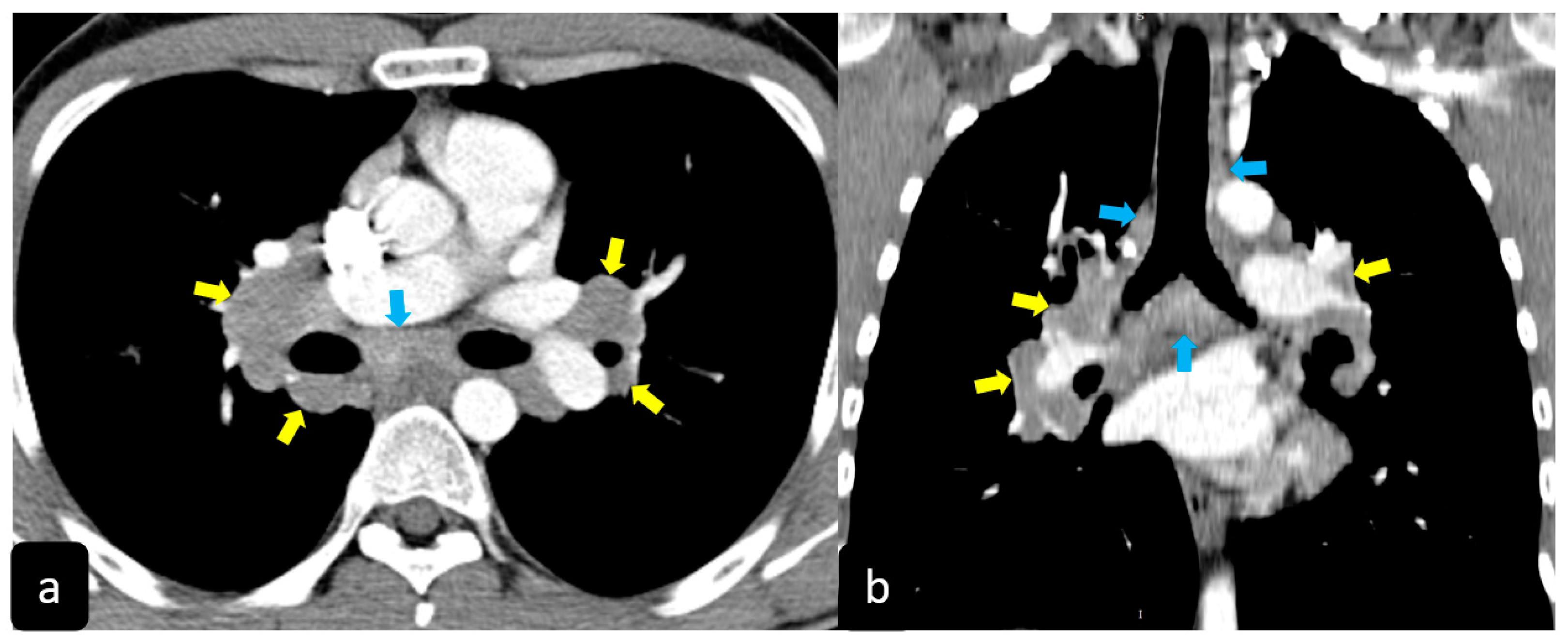 Diagnostics 11 00183 g003 Diagnostics 11 00183 g003