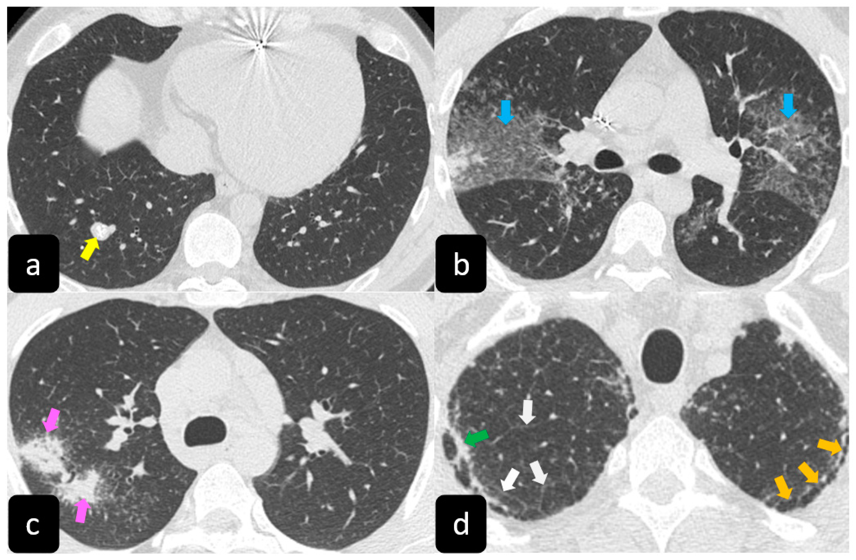 Diagnostics 11 00183 g004 Diagnostics 11 00183 g004