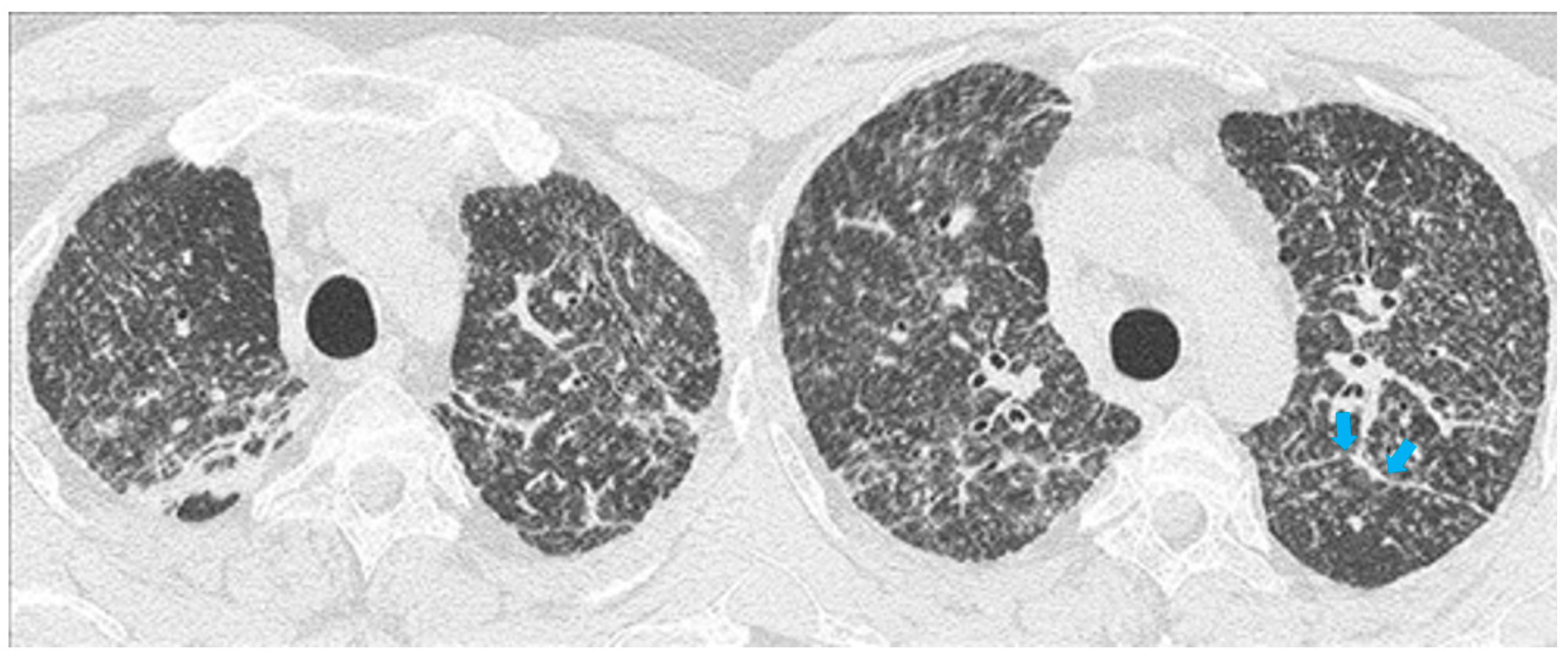 Diagnostics 11 00183 g005 Diagnostics 11 00183 g005