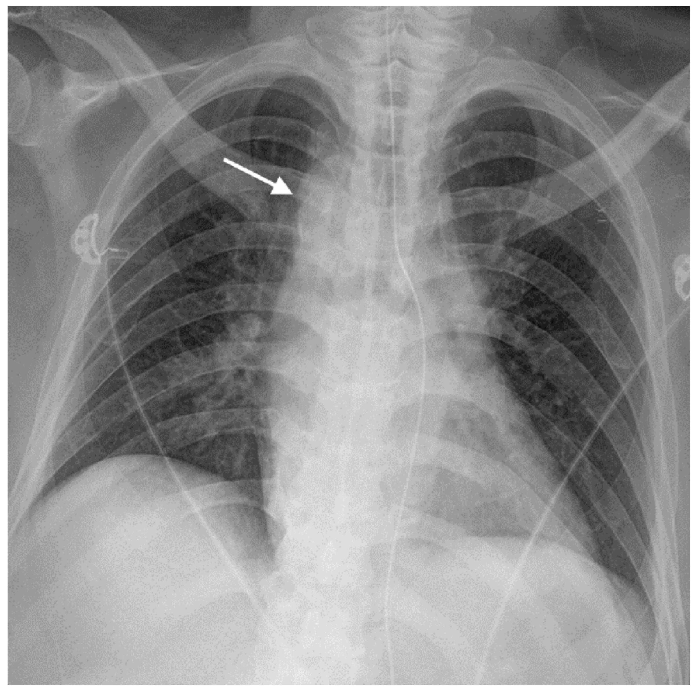 Diagnostics 11 00195 g002 Diagnostics 11 00195 g002