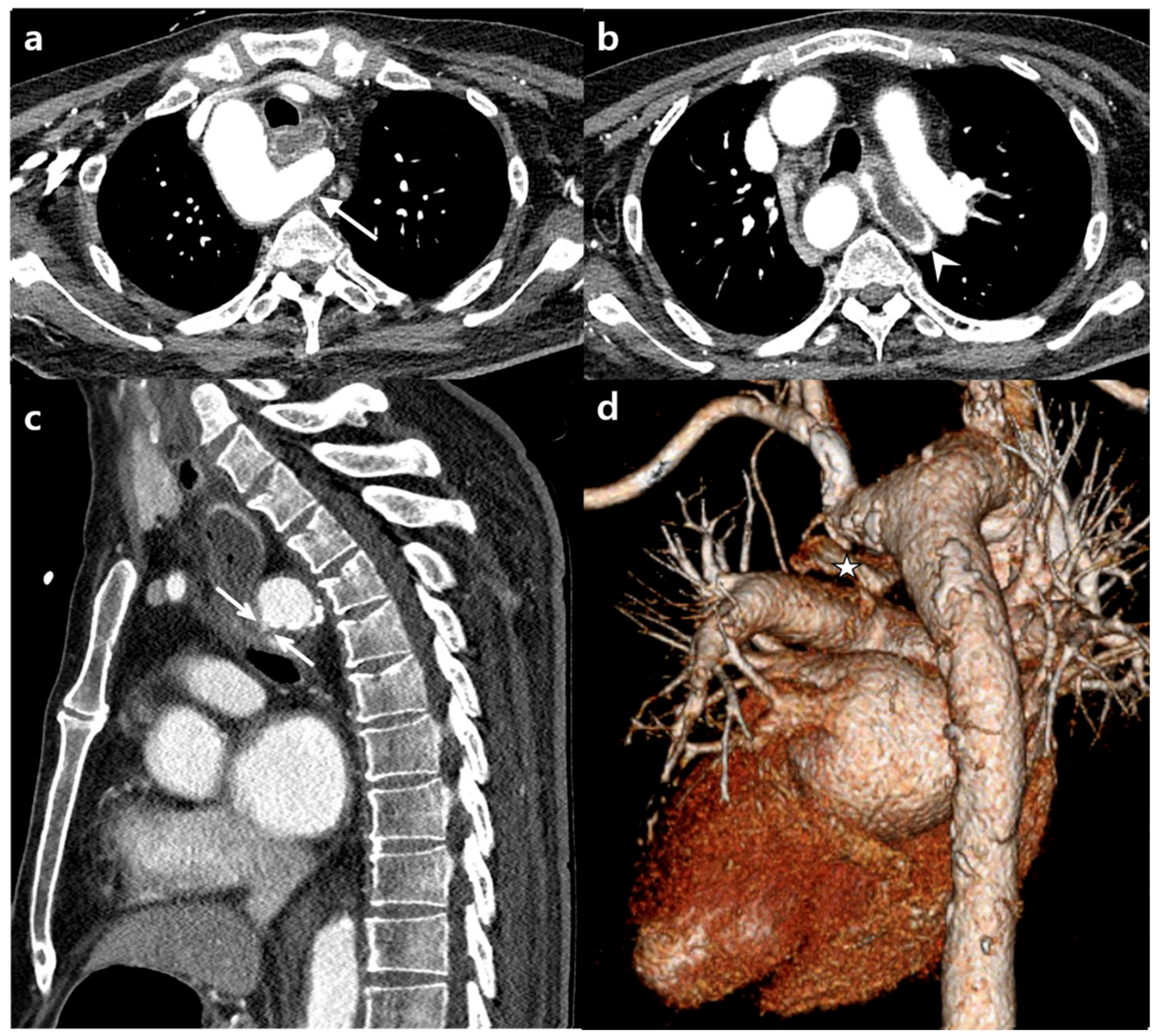 Diagnostics 11 00195 g004 Diagnostics 11 00195 g004
