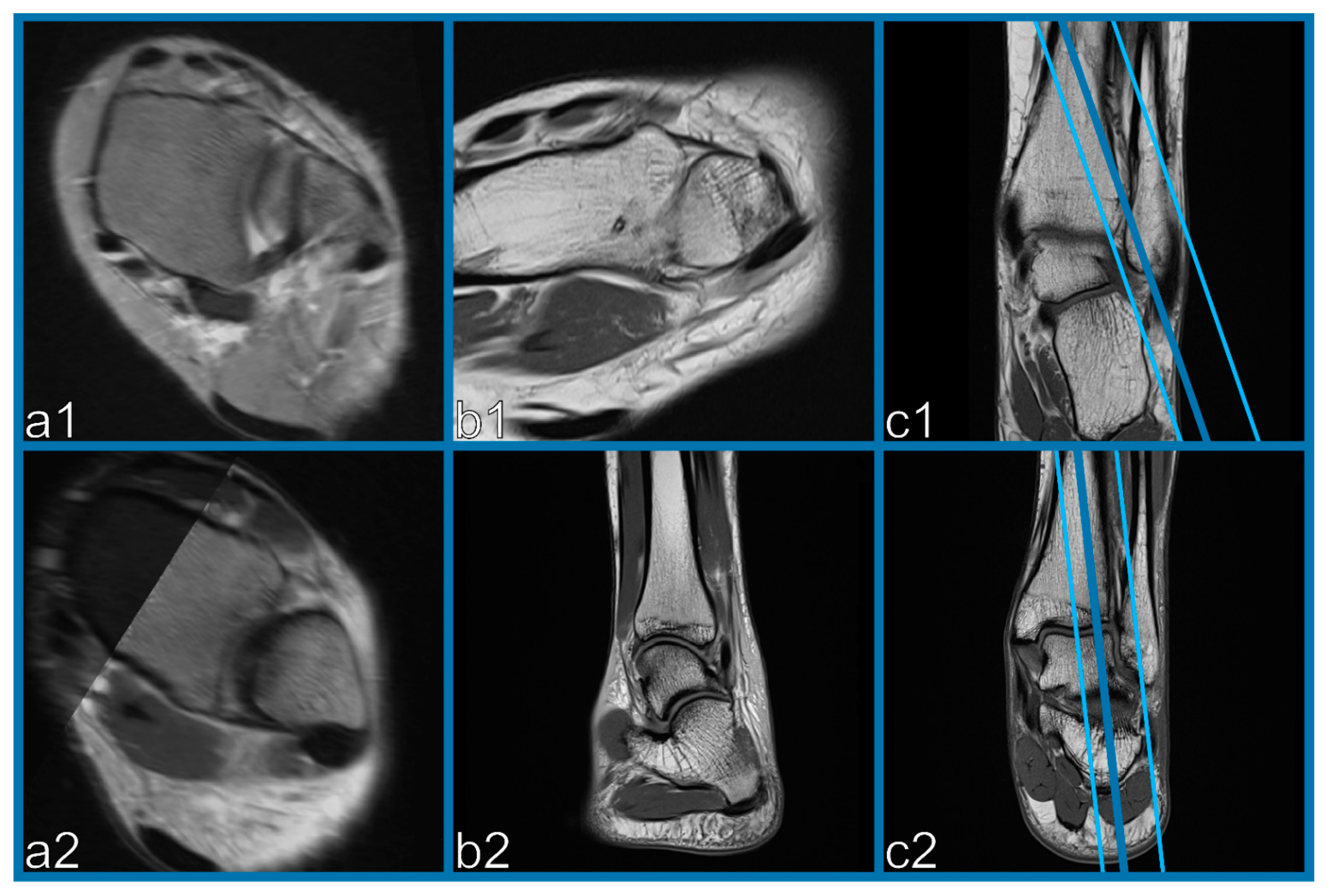 Diagnostics 11 00197 g003 Diagnostics 11 00197 g003