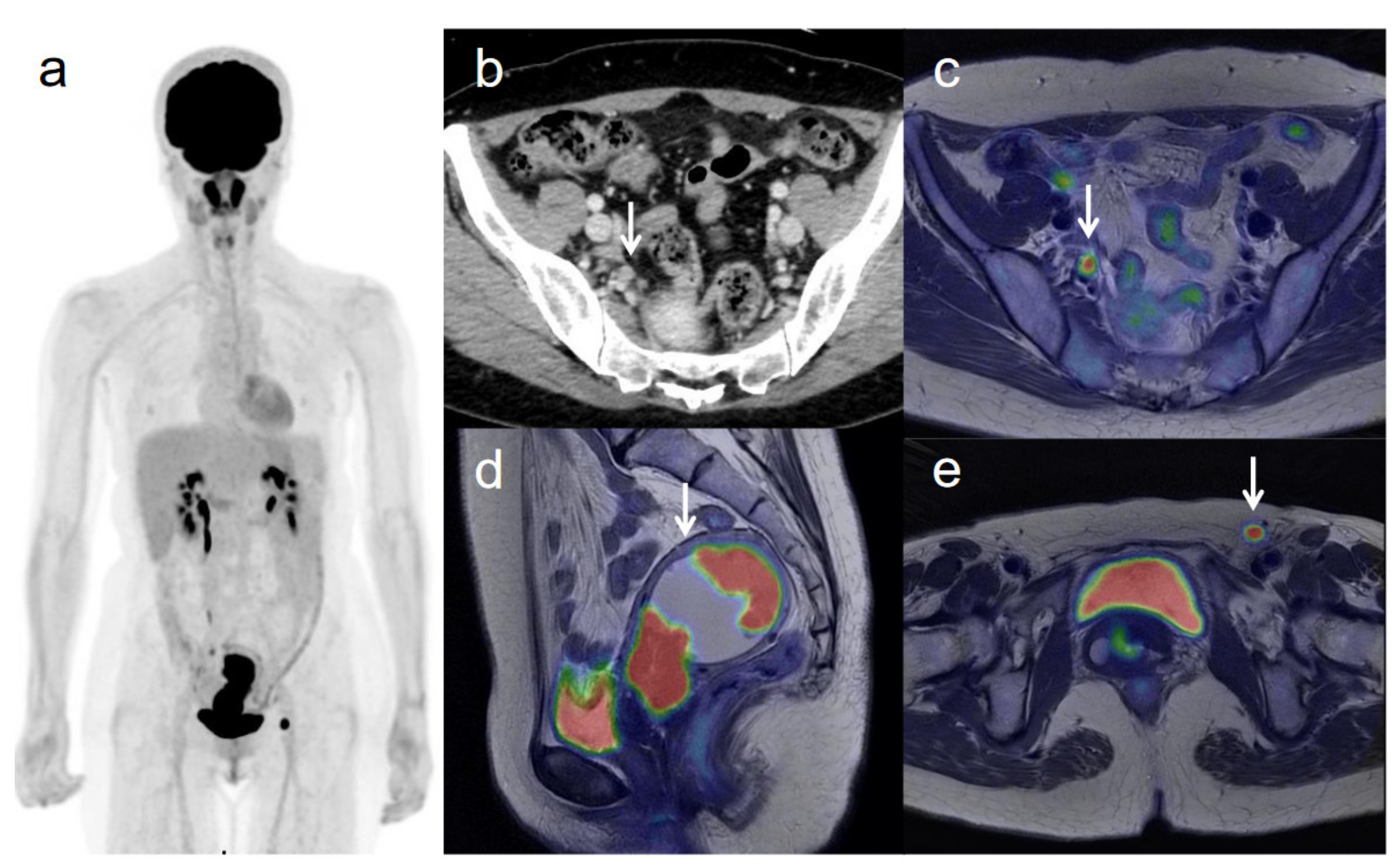 Diagnostics 11 00202 g003