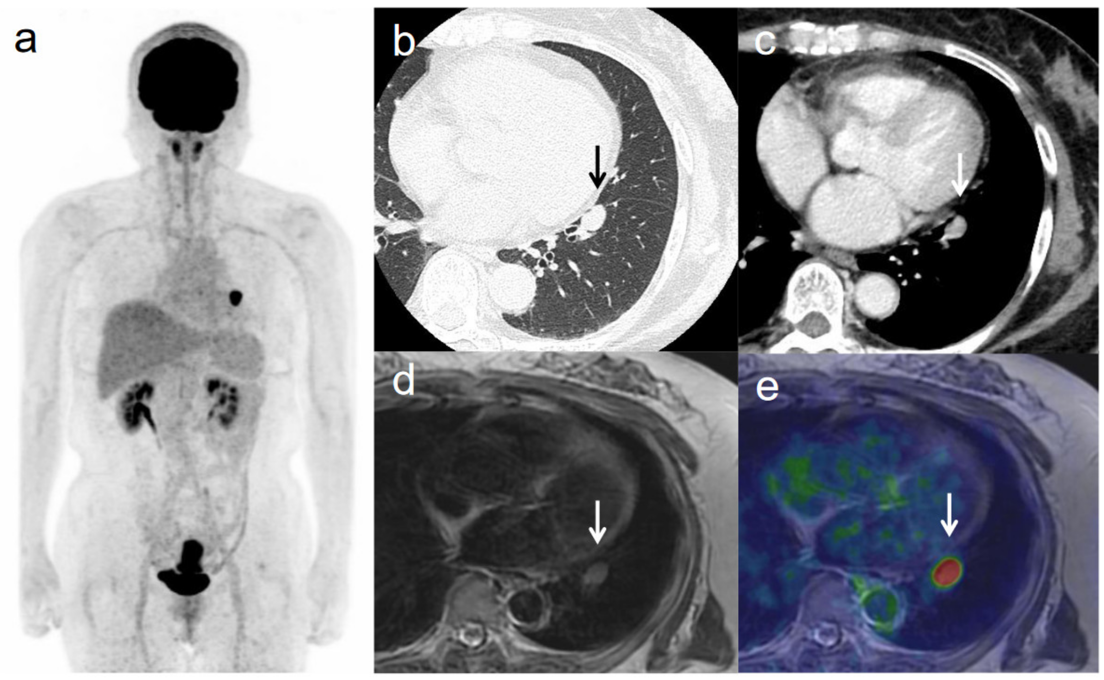 Diagnostics 11 00202 g005