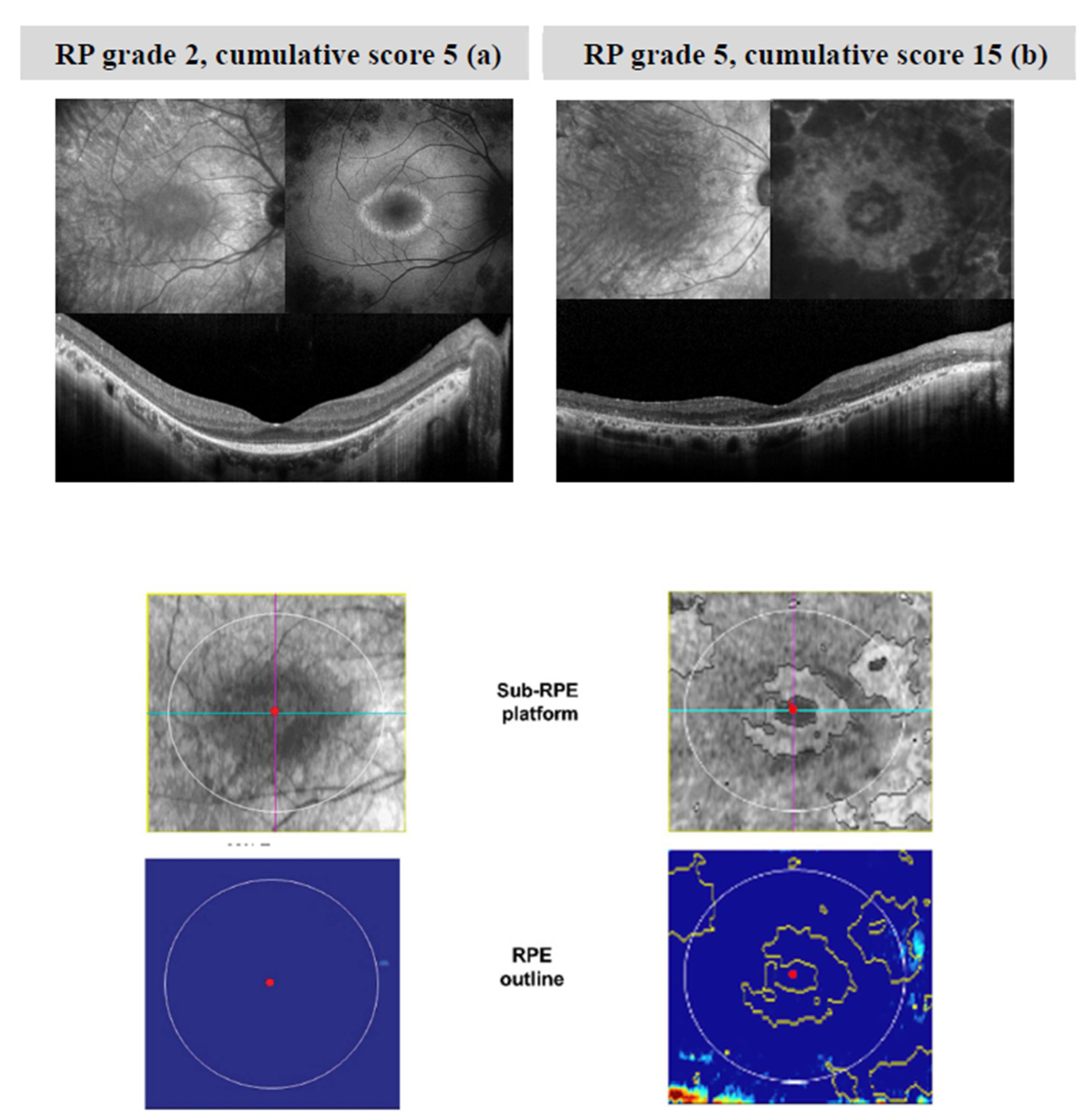 Diagnostics 11 00213 g001 Diagnostics 11 00213 g001
