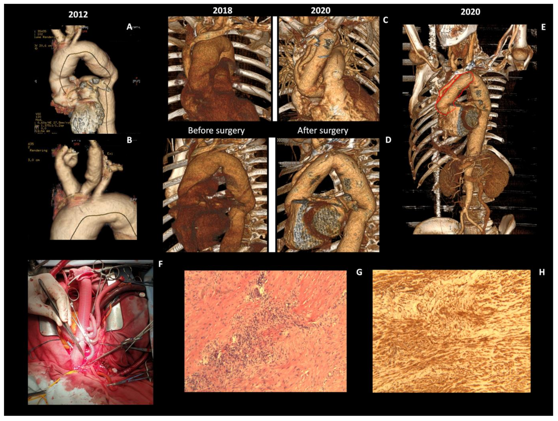 Diagnostics 11 00216 g002 Diagnostics 11 00216 g002