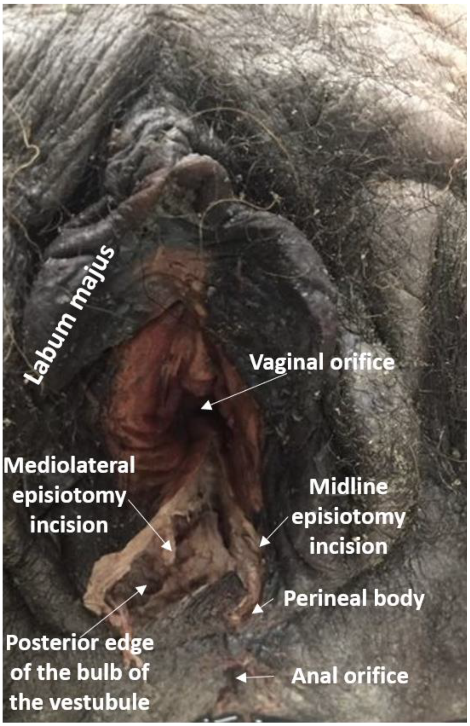 Diagnostics 11 00221 g002
