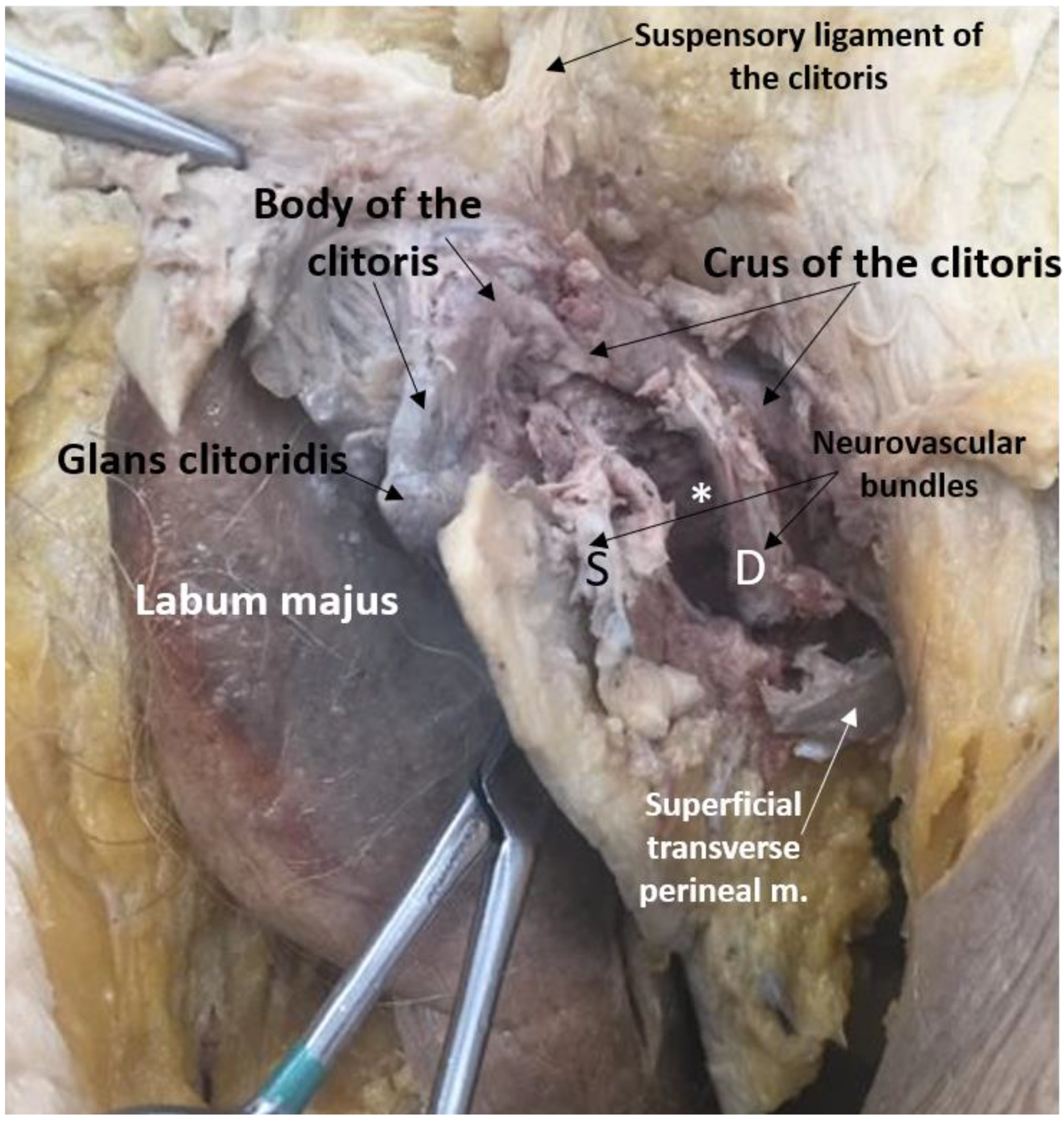 Diagnostics 11 00221 g004