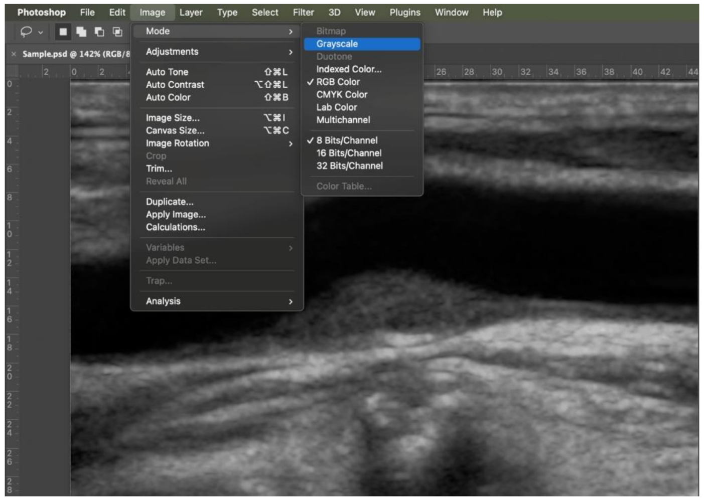 Diagnostics 11 00229 g002 Diagnostics 11 00229 g002