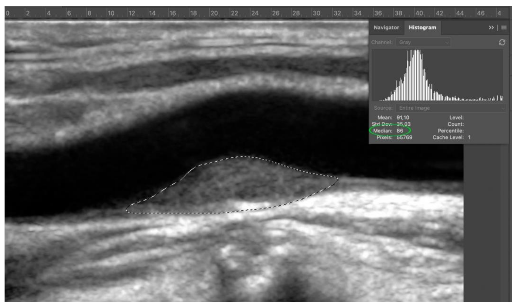 Diagnostics 11 00229 g005 Diagnostics 11 00229 g005