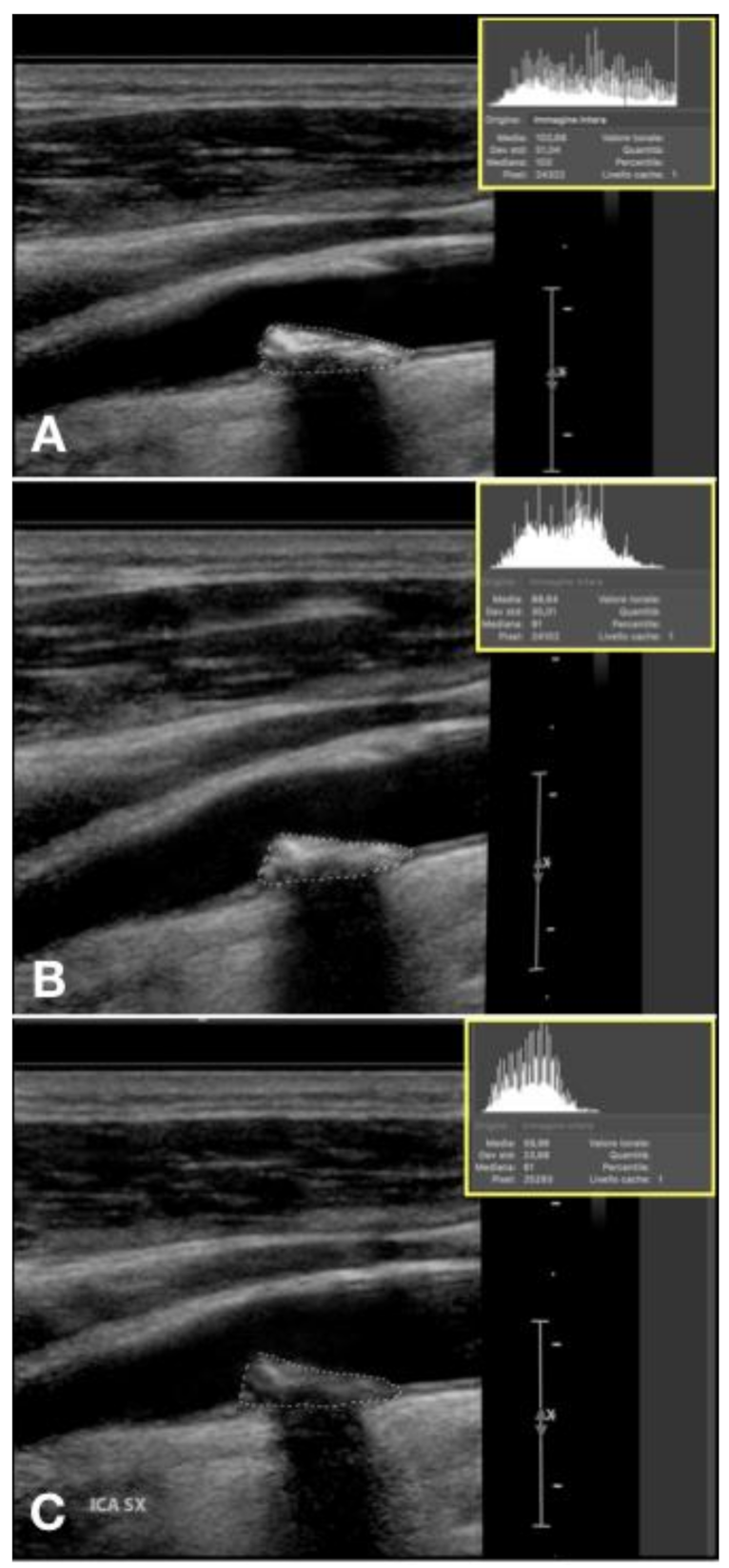 Diagnostics 11 00229 g009 Diagnostics 11 00229 g009