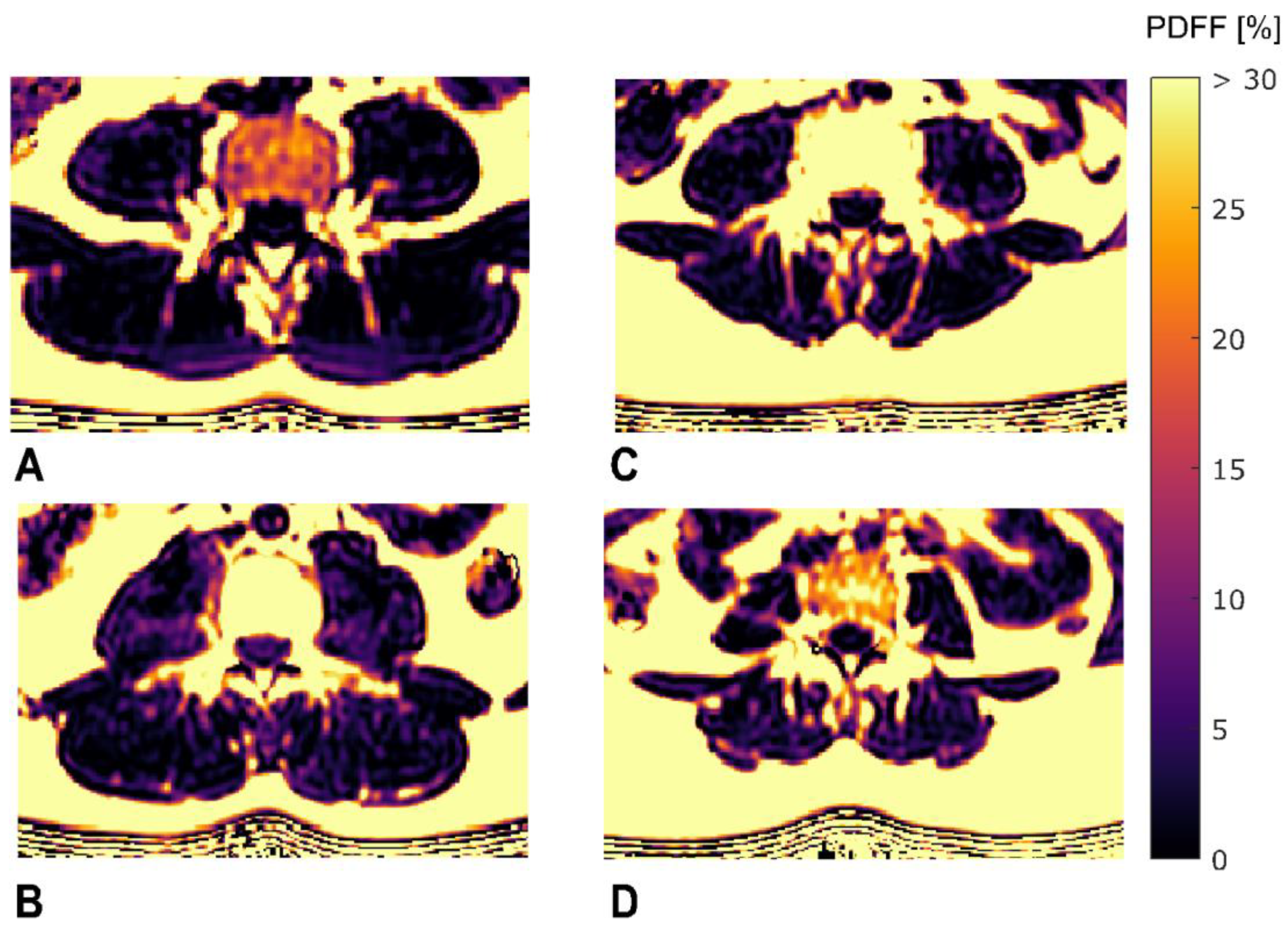 Diagnostics 11 00239 g004 Diagnostics 11 00239 g004