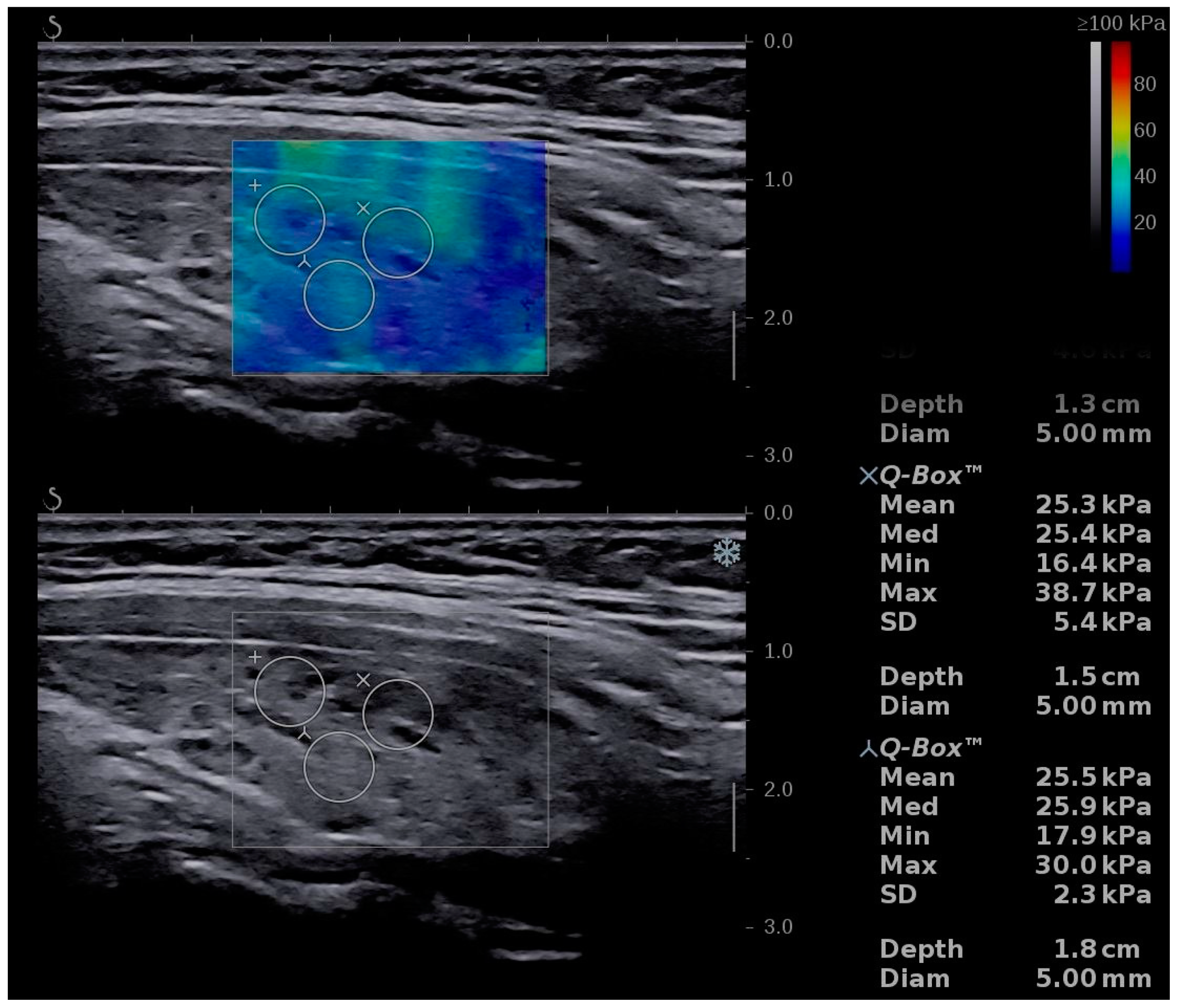 Diagnostics 11 00248 g003