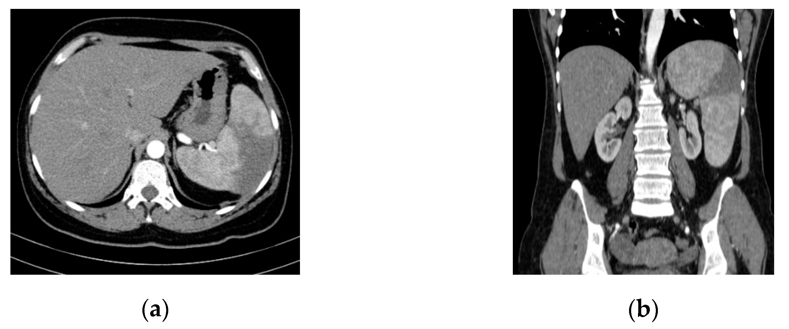 Diagnostics 11 00251 g001