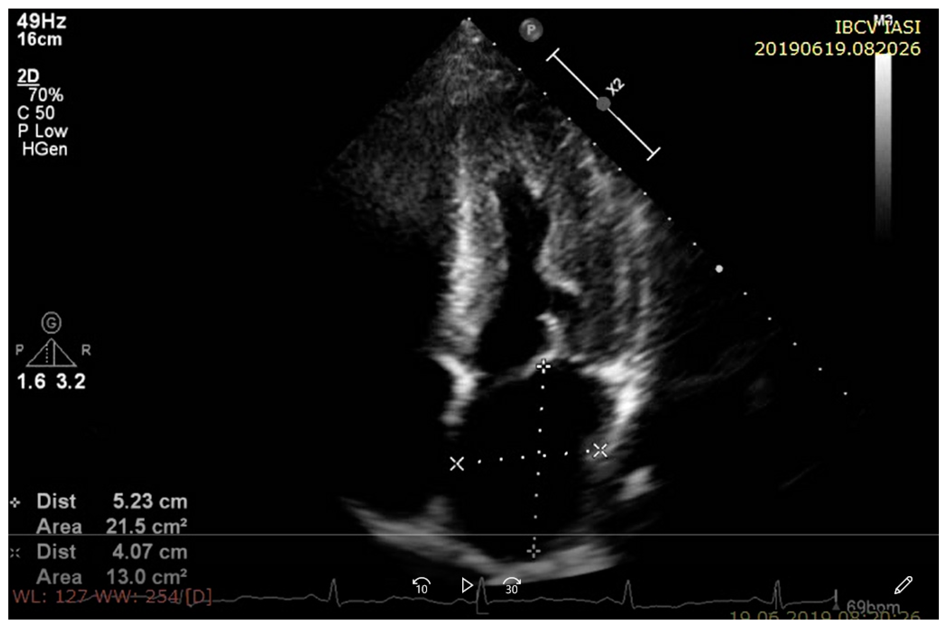 Diagnostics Free Full Text The Importance Of Multimodality Imaging