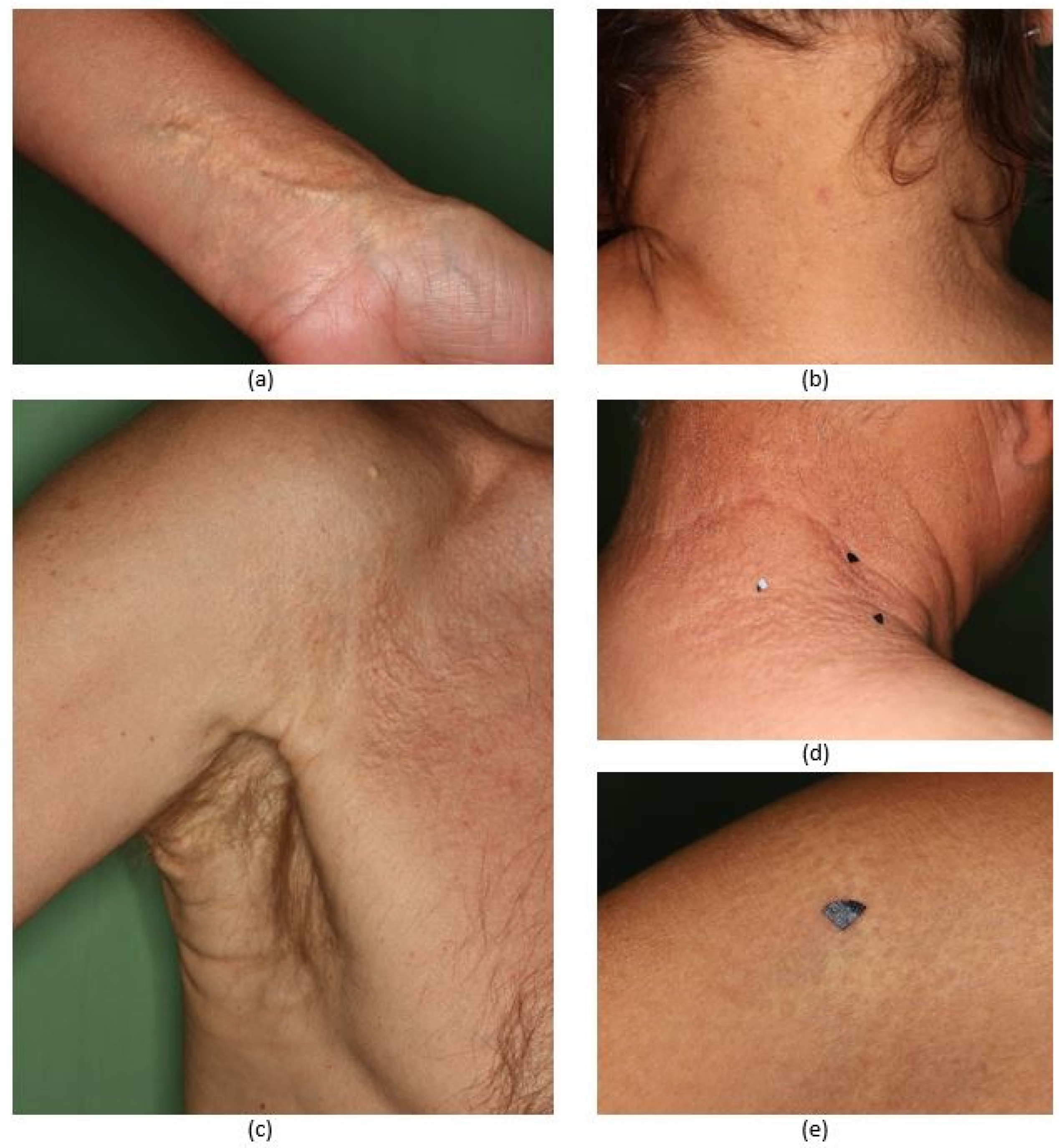 Diagnostics 11 00260 g001 Diagnostics 11 00260 g001