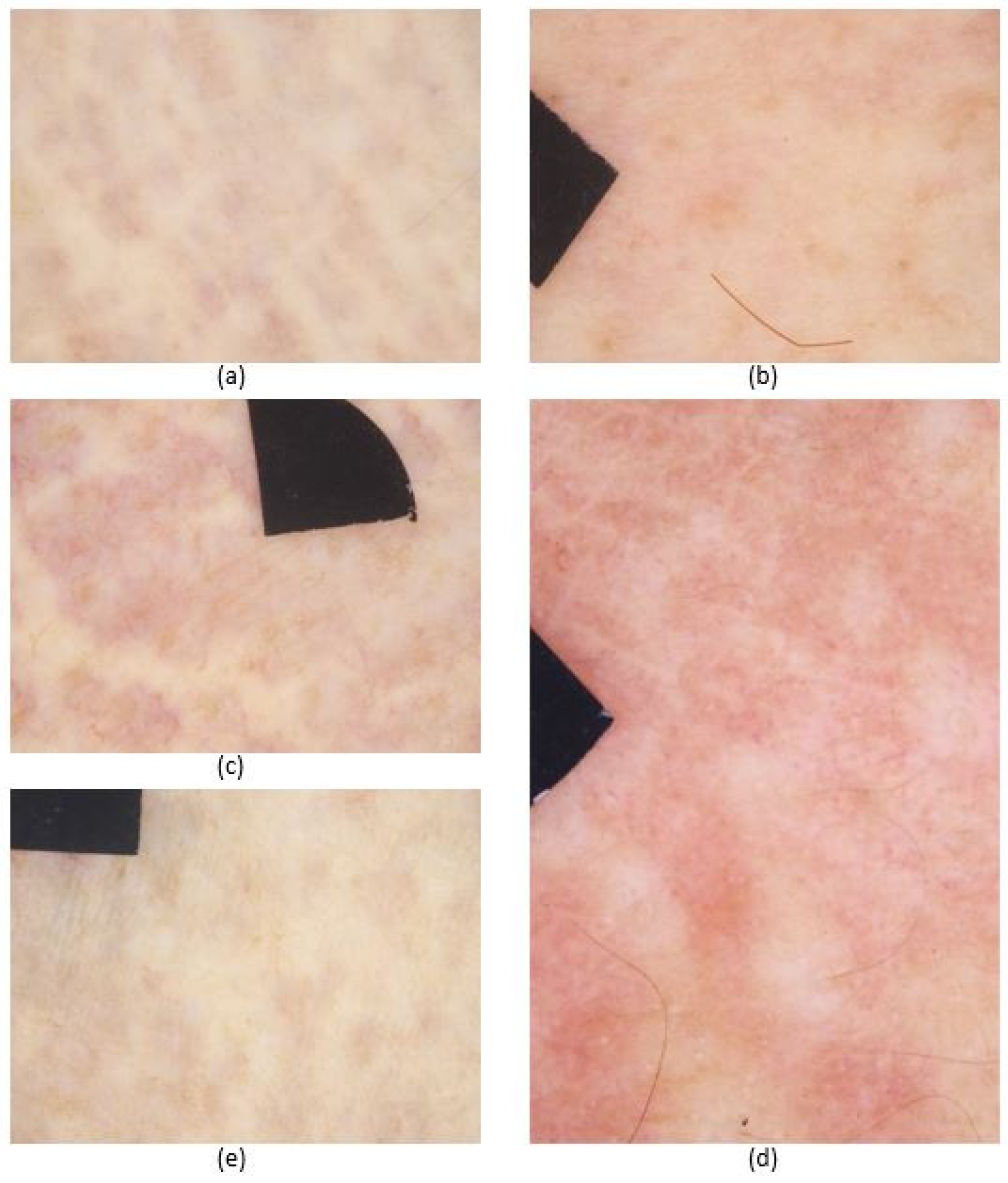 Diagnostics 11 00260 g003 Diagnostics 11 00260 g003