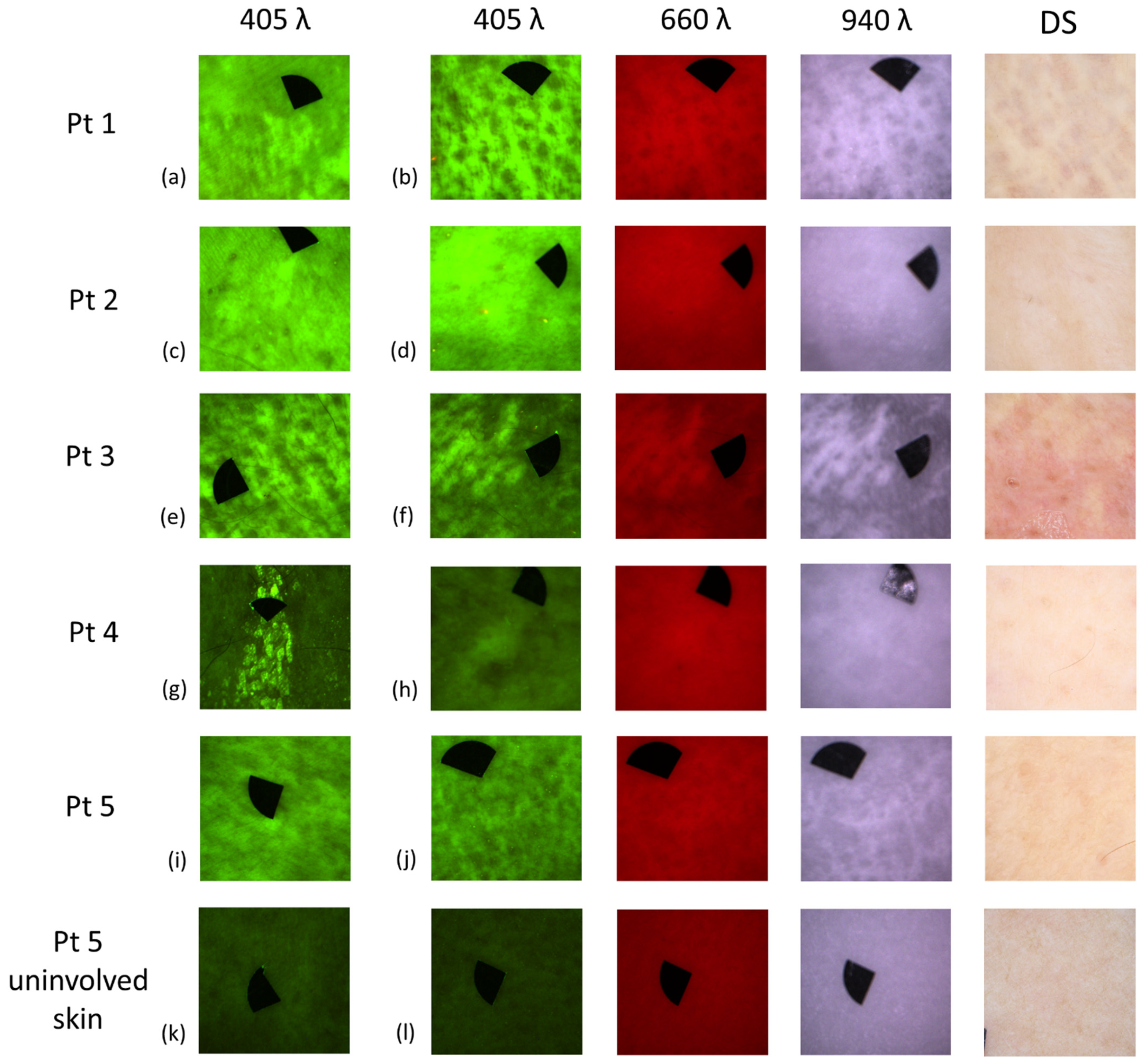 Diagnostics 11 00260 g004 Diagnostics 11 00260 g004