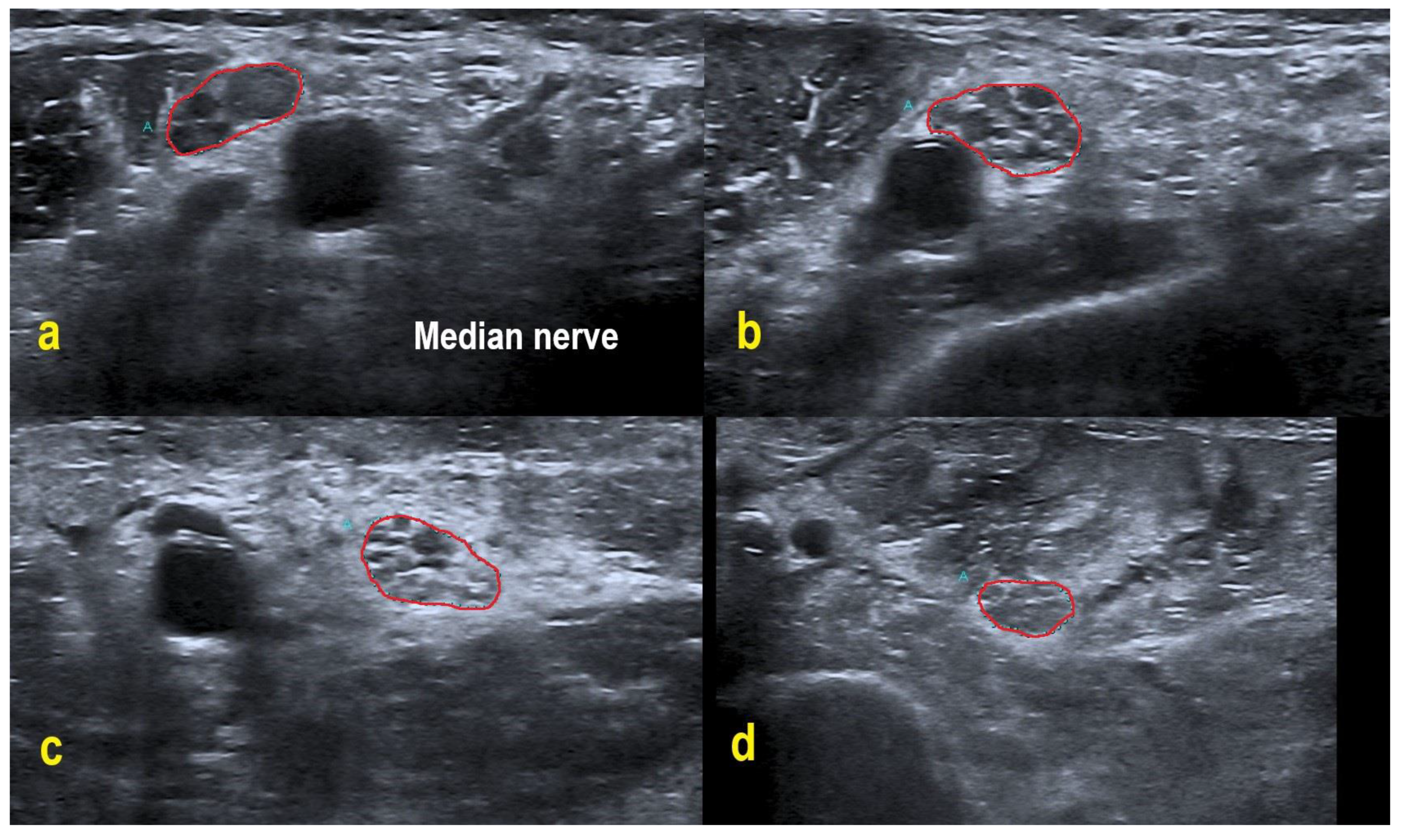 Diagnostics 11 00264 g002