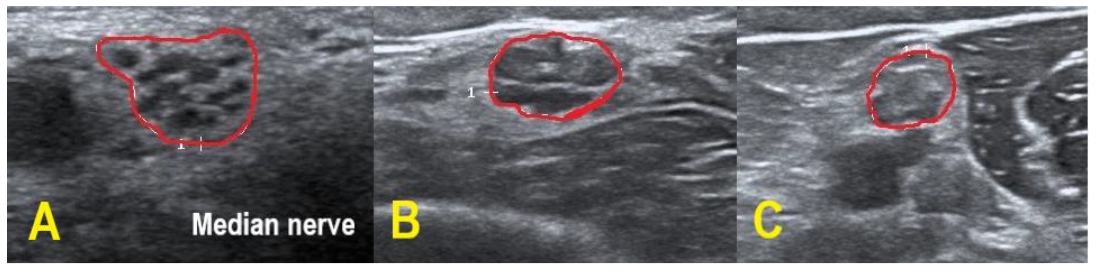 Diagnostics 11 00264 g003