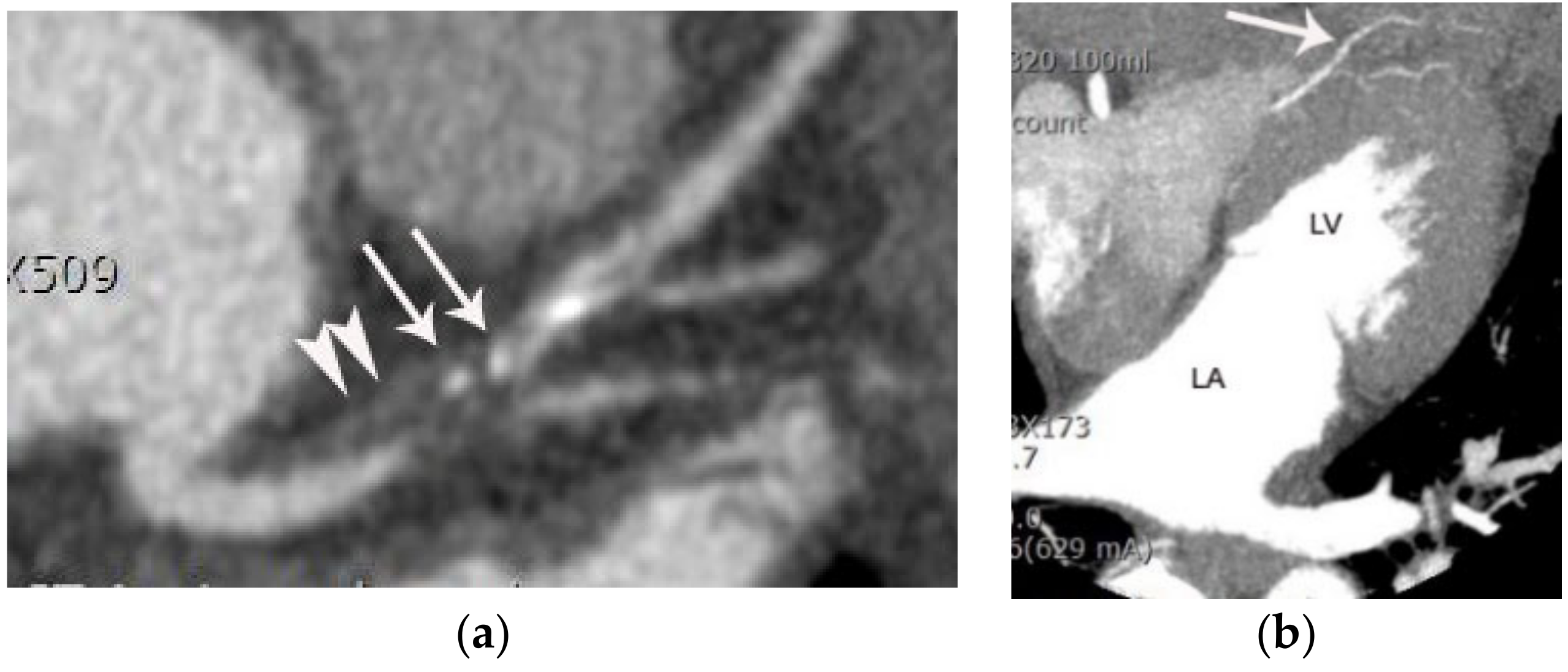 Diagnostics 11 00266 g005 Diagnostics 11 00266 g005